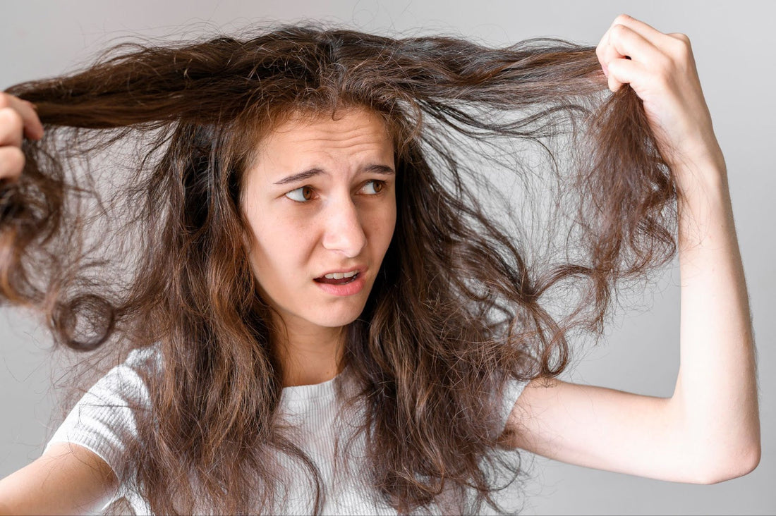 hairfall epidemic