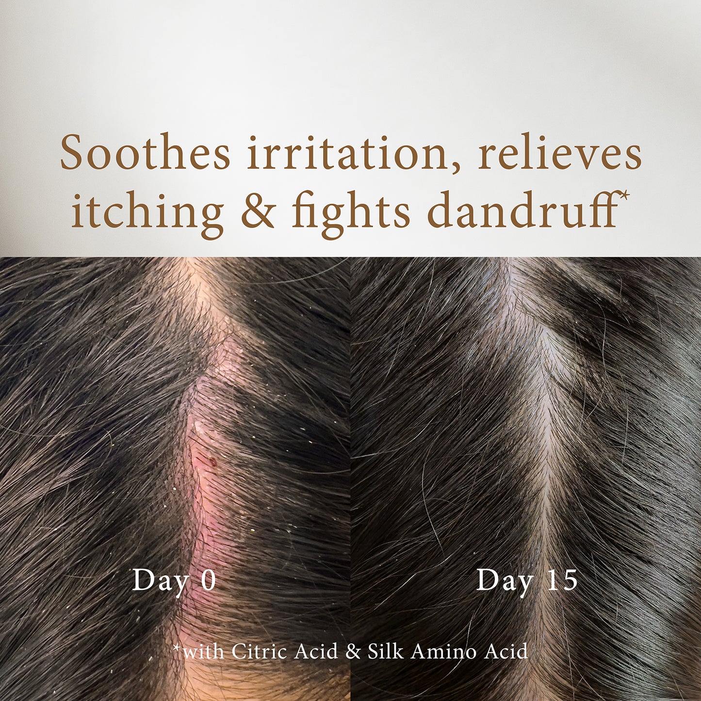 Rose & Oud Shampoo - Long-Lasting Fragrance & Hair Fall Protection - 500ml