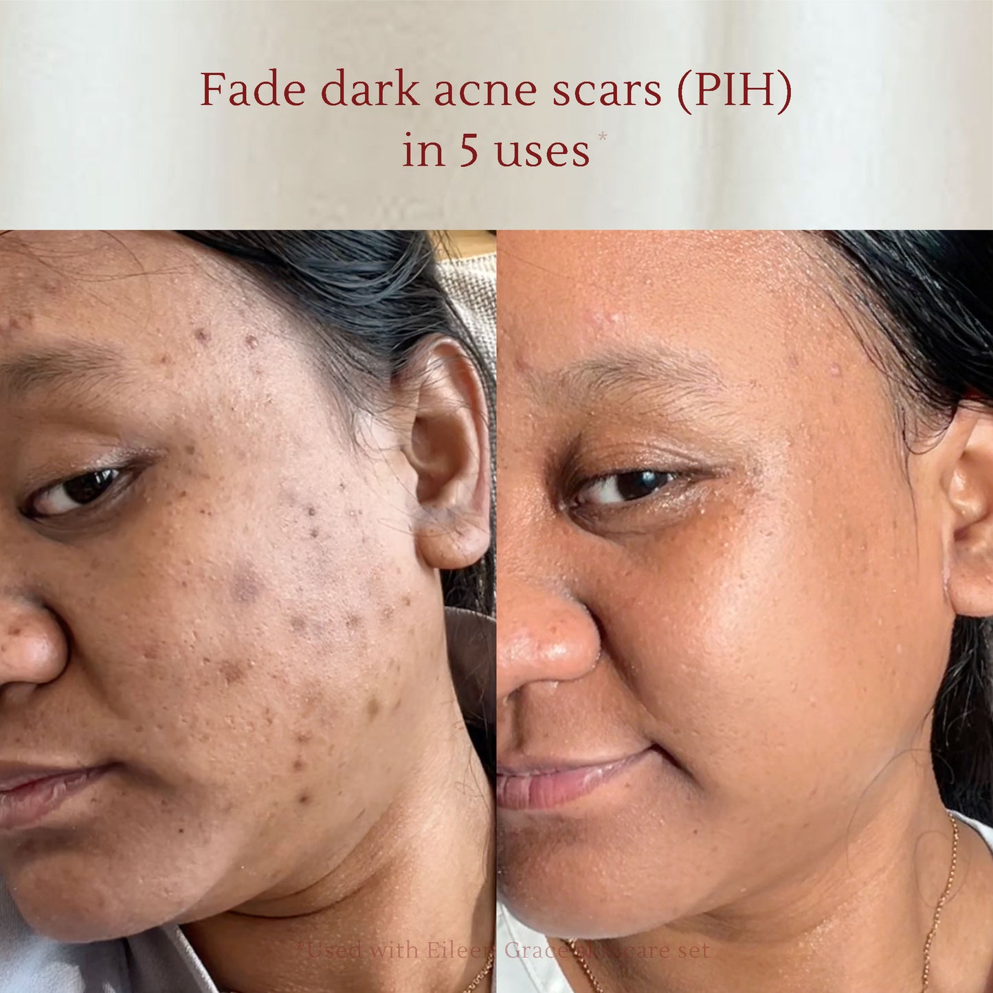 Deep Cleansing Set – Removes Impurities, Minimizes Pores, Brightens Skin Tone – Suitable for Daily Use on All Skin Types