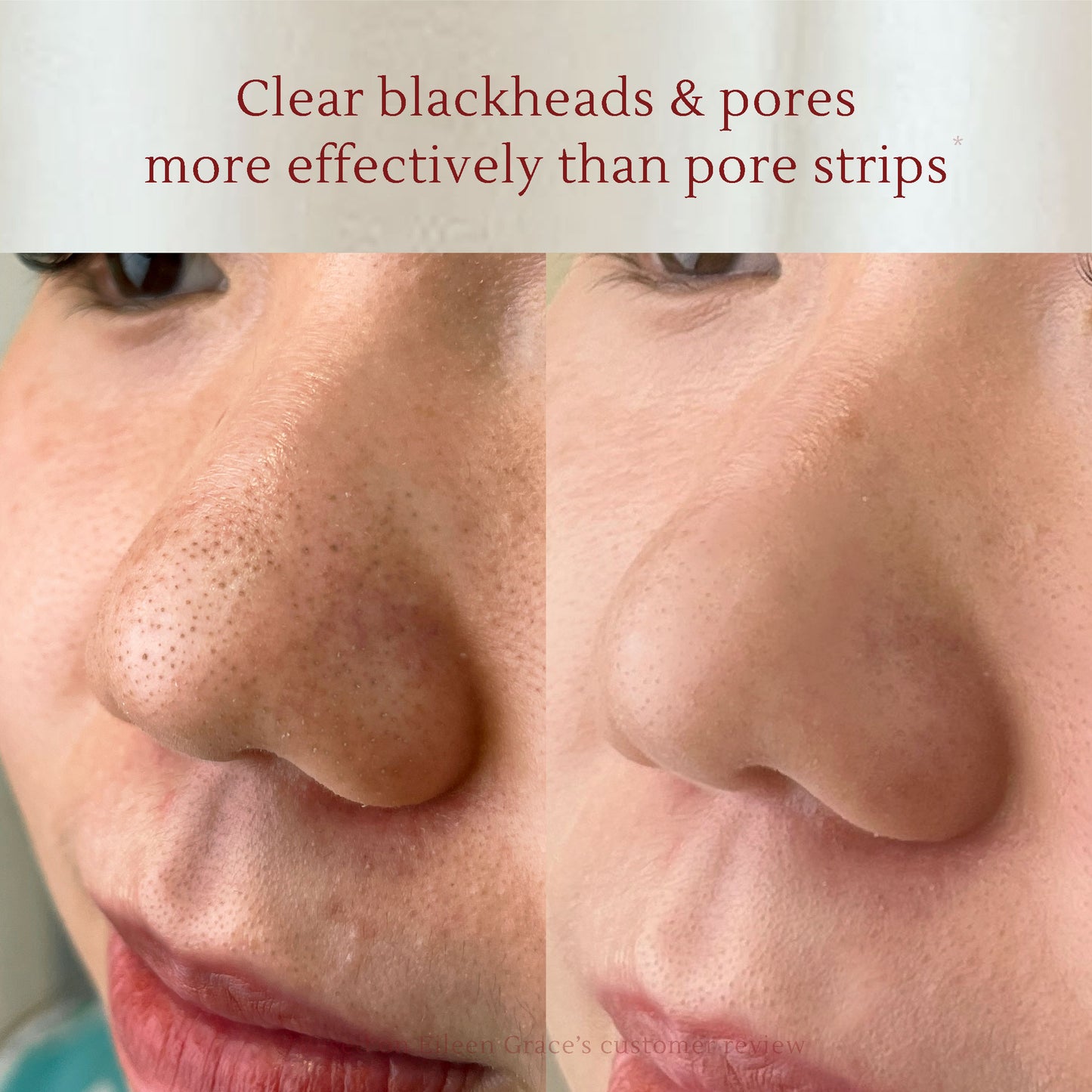 Deep Cleansing Set – Removes Impurities, Minimizes Pores, Brightens Skin Tone – Suitable for Daily Use on All Skin Types