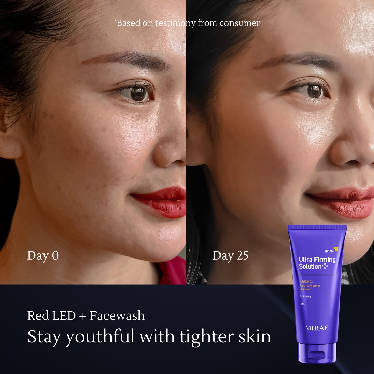Mirae Anti Aging Solution – Lifts & Firms, Fades Fine Lines, Brightens Dull Skin – Retinol-Based & Safe with Sunscreen Protection