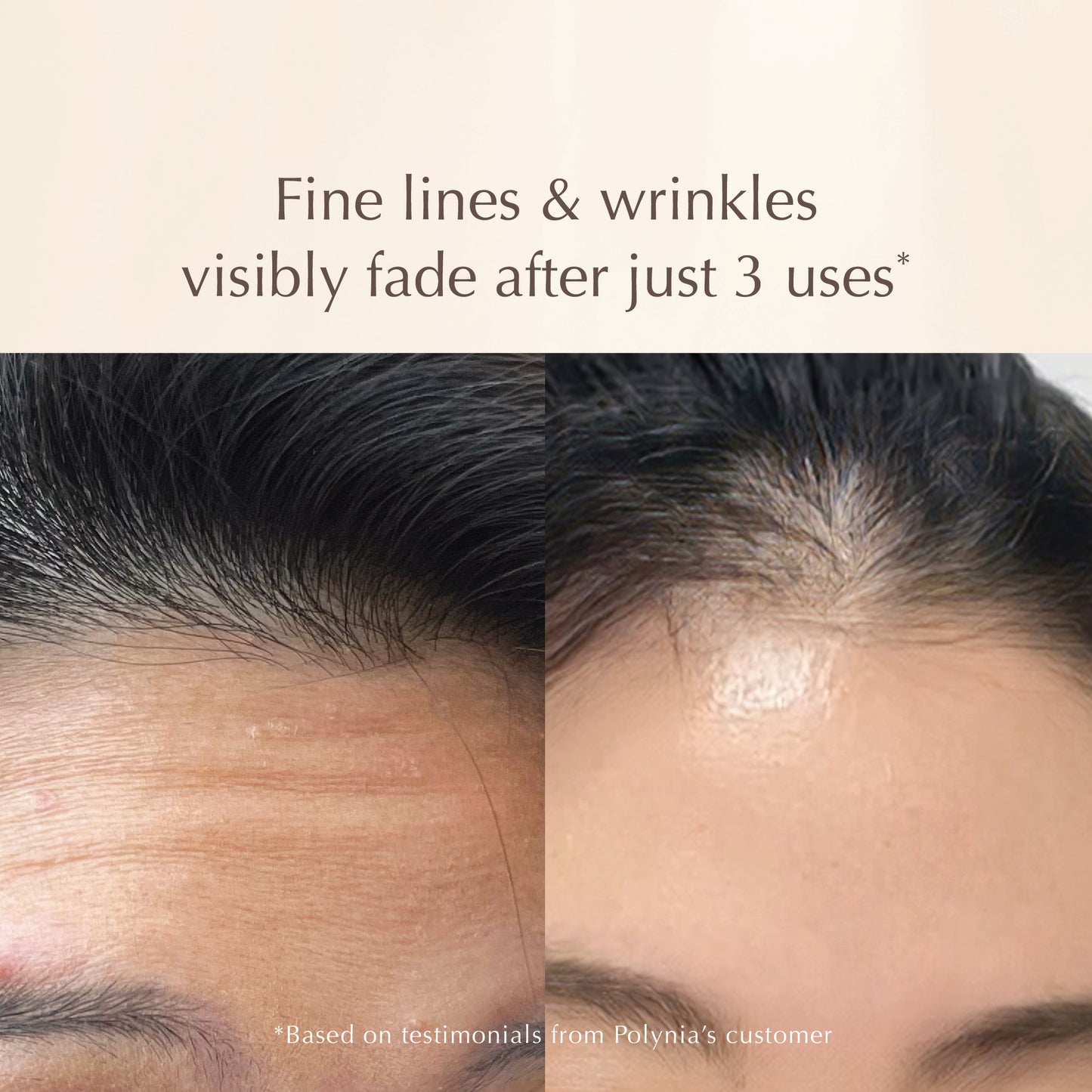 All-in-One Lifting Solution – Firms Skin, Reduces Wrinkles, Deeply Hydrates – Safe for All Skin Types Including Sensitive