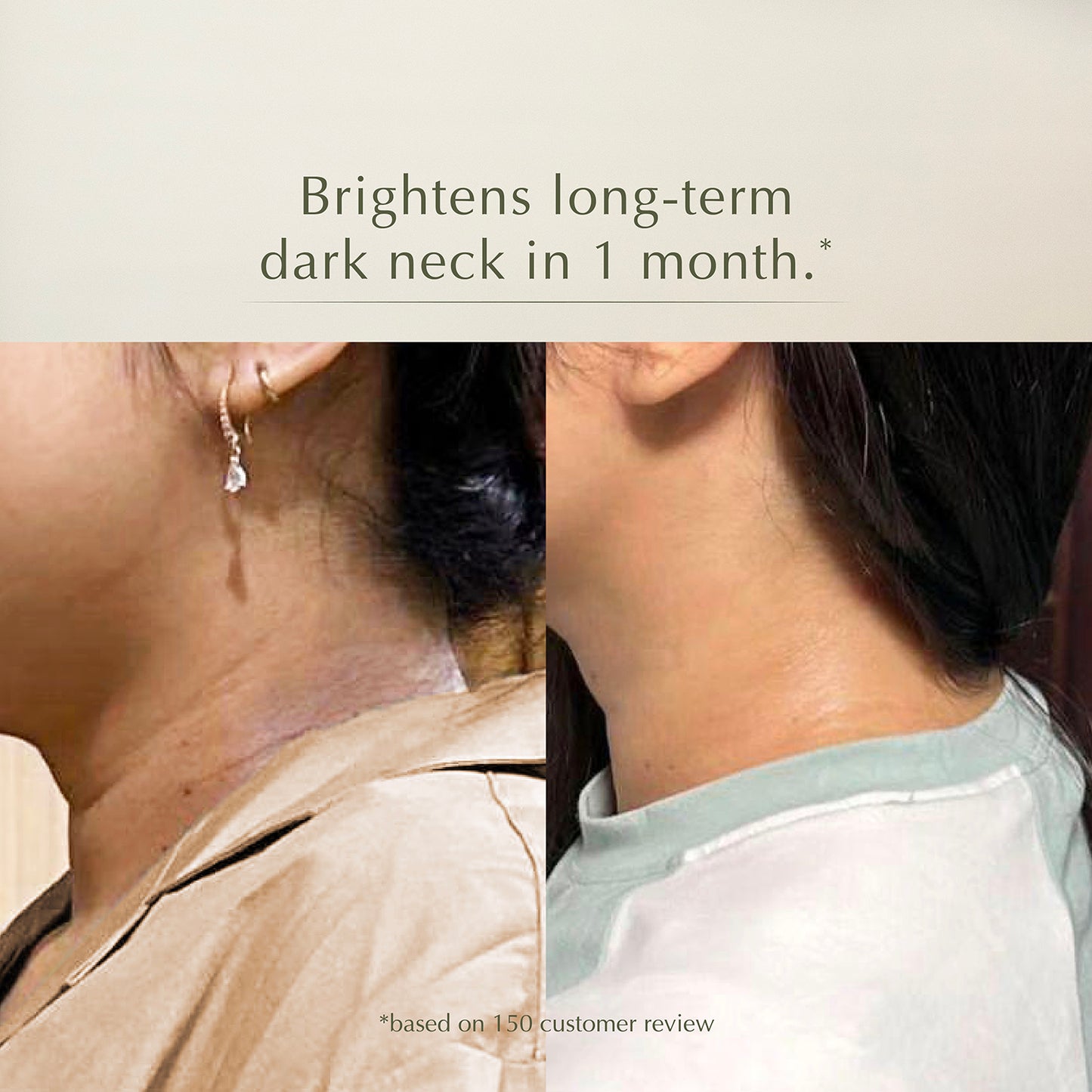 Mosseru Brightening Care – Brightens Dull Areas, Hydrates Deeply, Strengthens Skin Barrier – Gentle & Safe for Sensitive Skin