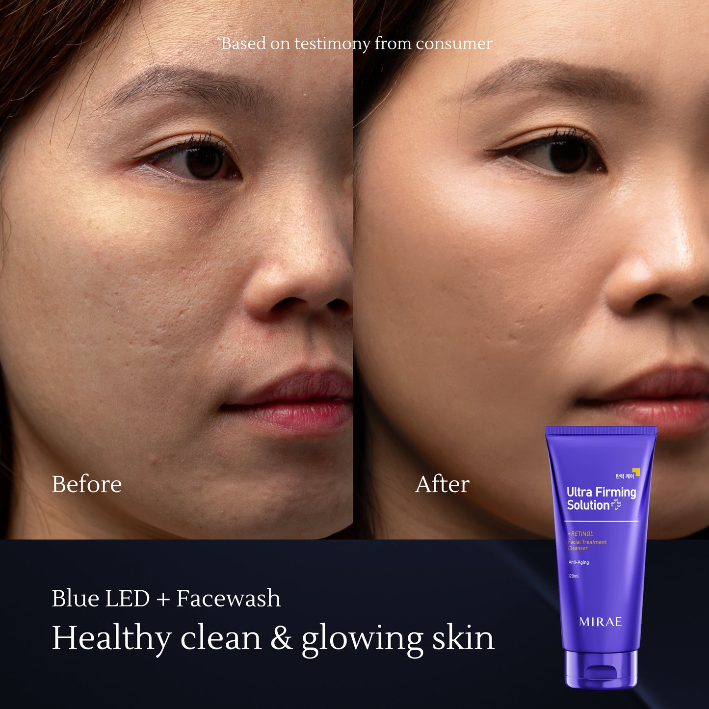 Mirae Anti Aging Solution – Lifts & Firms, Fades Fine Lines, Brightens Dull Skin – Retinol-Based & Safe with Sunscreen Protection
