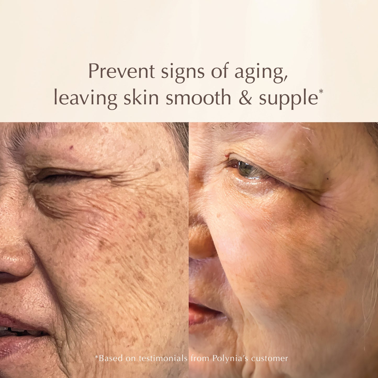 All-in-One Lifting Solution – Firms Skin, Reduces Wrinkles, Deeply Hydrates – Safe for All Skin Types Including Sensitive
