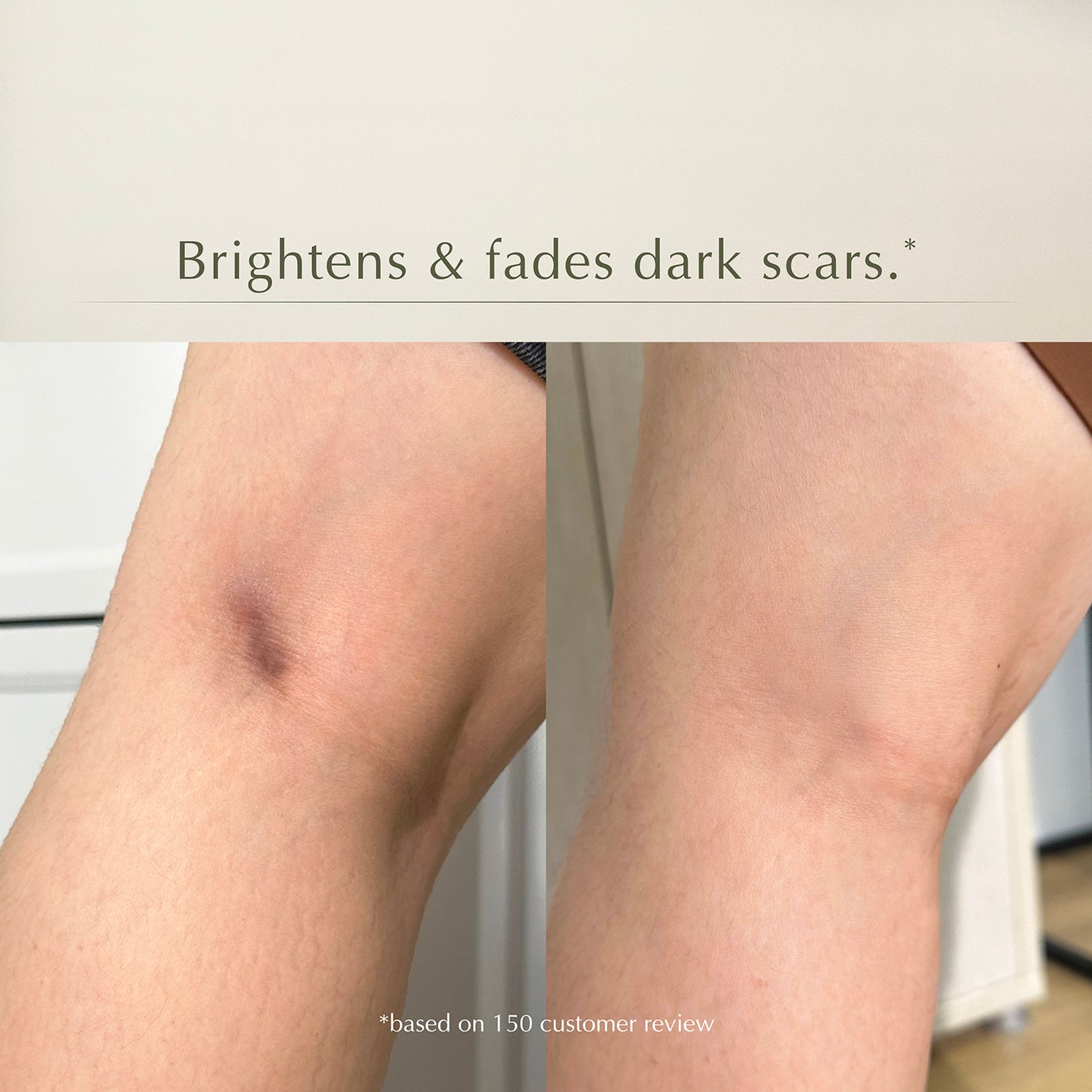 Mosseru Brightening Care – Brightens Dull Areas, Hydrates Deeply, Strengthens Skin Barrier – Gentle & Safe for Sensitive Skin