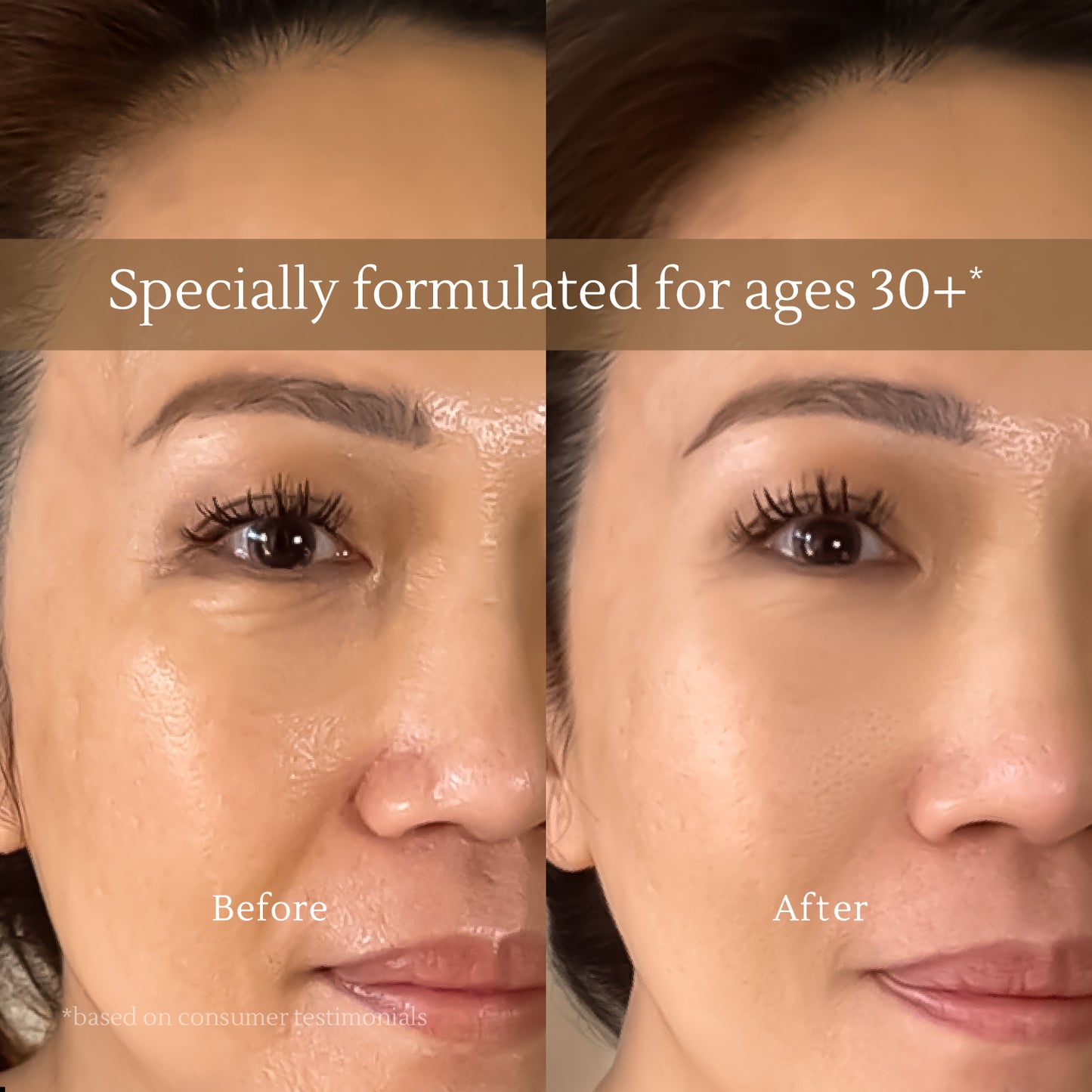 All-in-One Lifting Solution – Firms Skin, Reduces Wrinkles, Deeply Hydrates – Safe for All Skin Types Including Sensitive