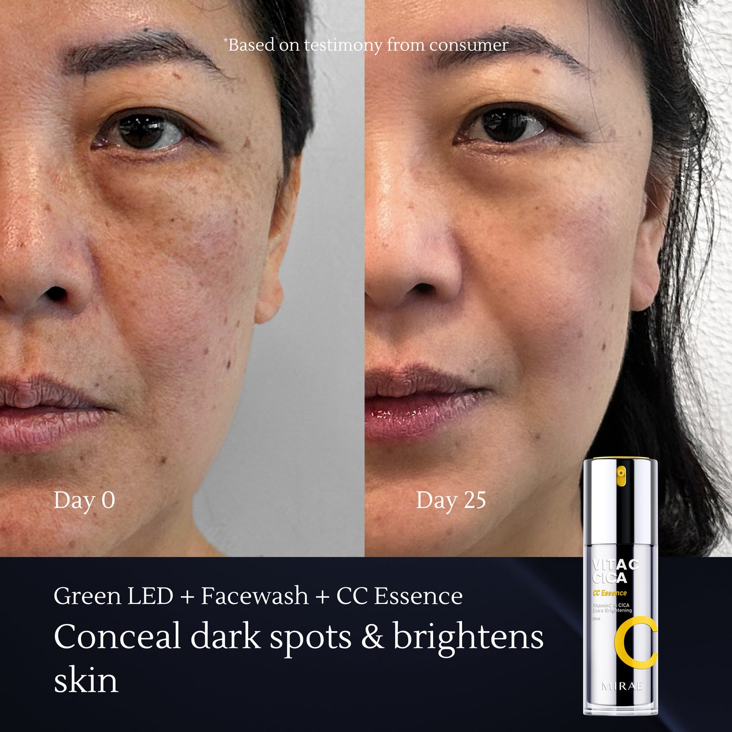 Vitamin C Skin Solution – Boosts Radiance, Brightens Dark Spots, Strengthens Skin Barrier – Gentle for Daily Use on All Skin Types