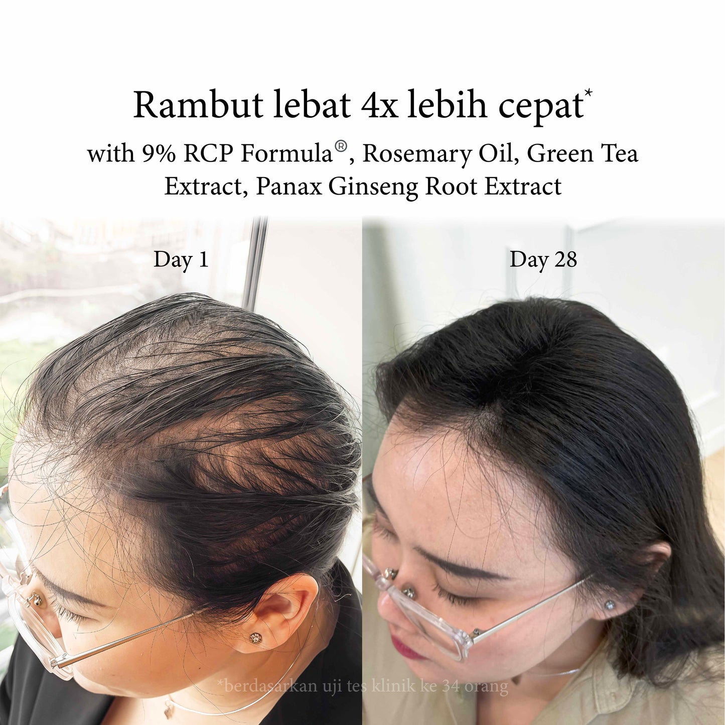 Hair Loss & Growth Essence - 50ml | Hair Essence | For Thinning & Hair Loss | Sensitive Scalp | Hair Care