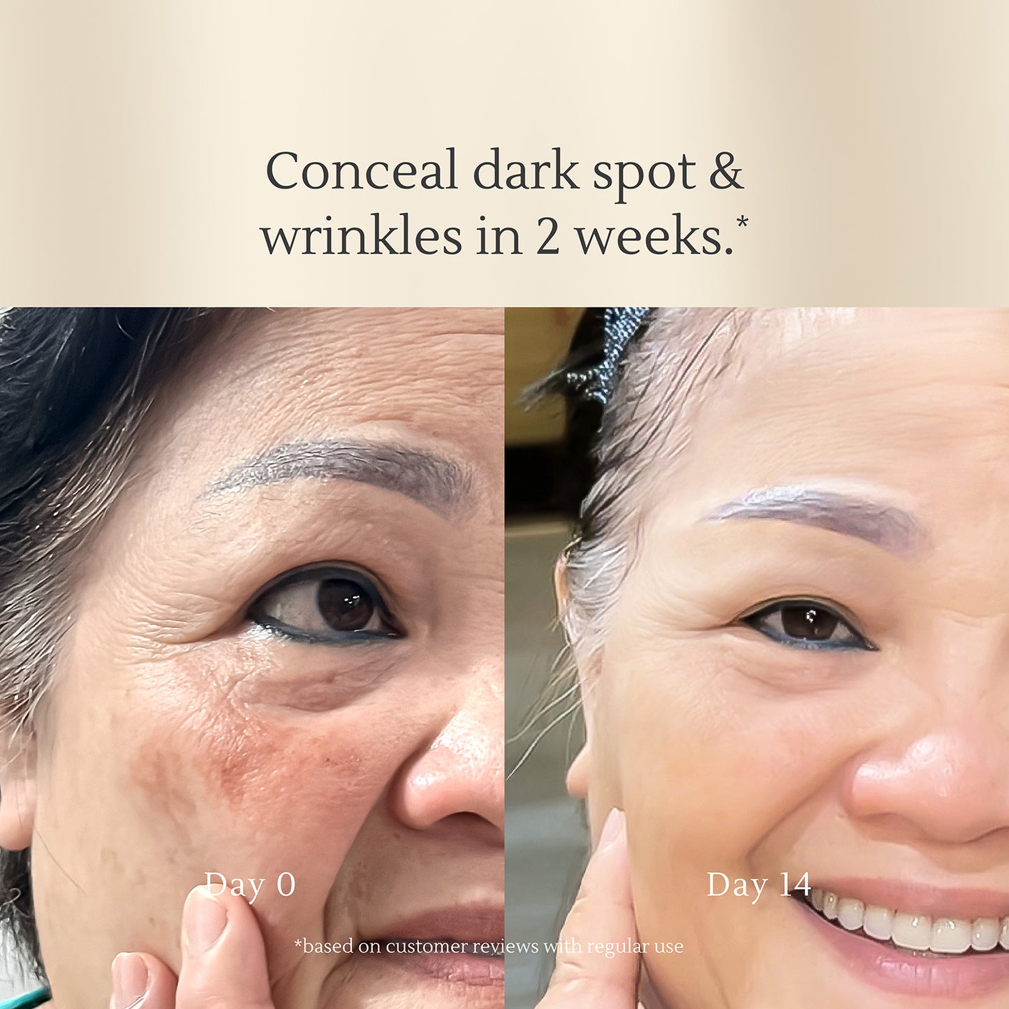 Spot-Free Set – Targets Blemishes, Improves Skin Texture, Evens Out Skin Tone – Suitable for Sensitive and Acne-Prone Skin