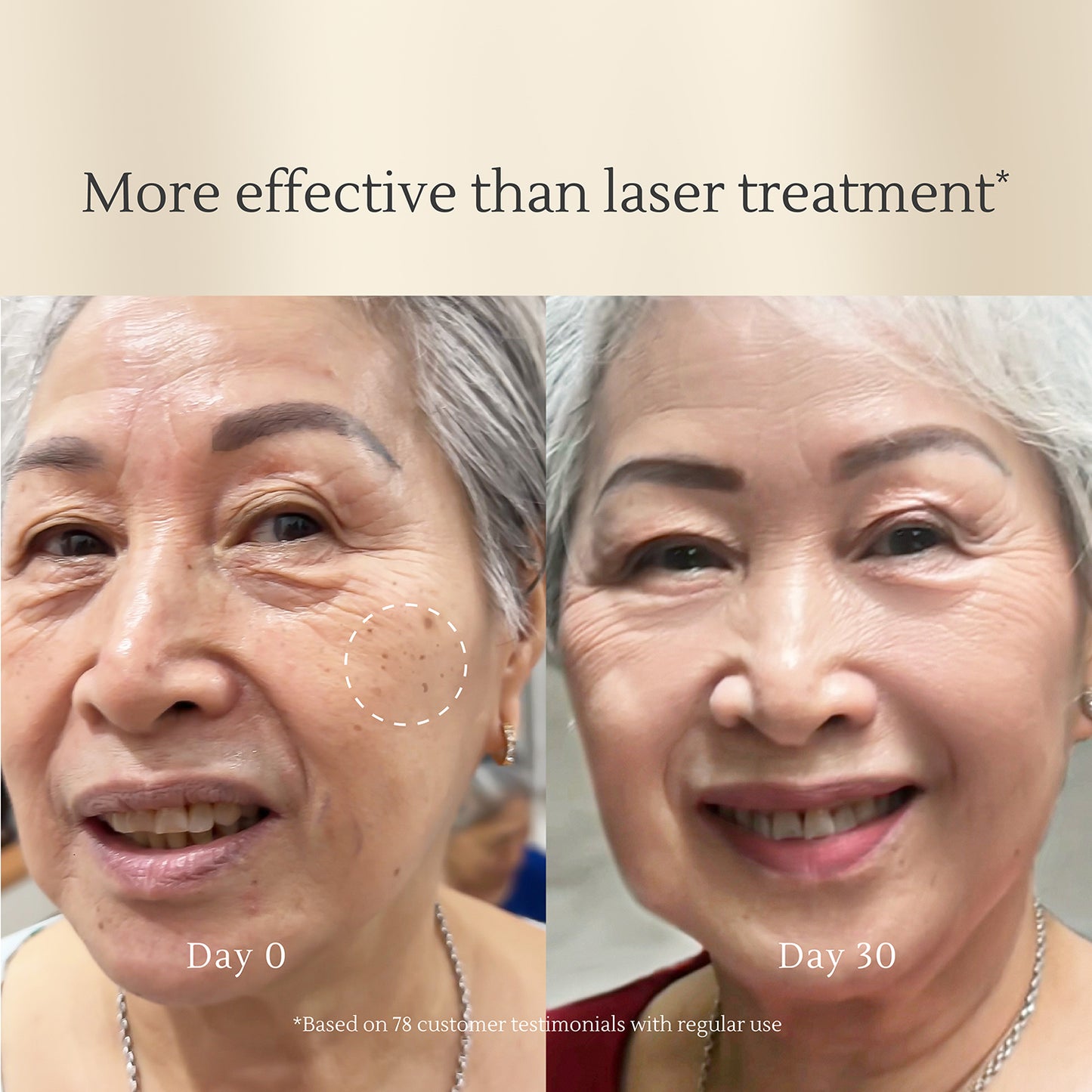 Intensive Dark Spot Care – Fades Acne Scars, Brightens Skin, Corrects Hyperpigmentation – Safe for All Skin Types