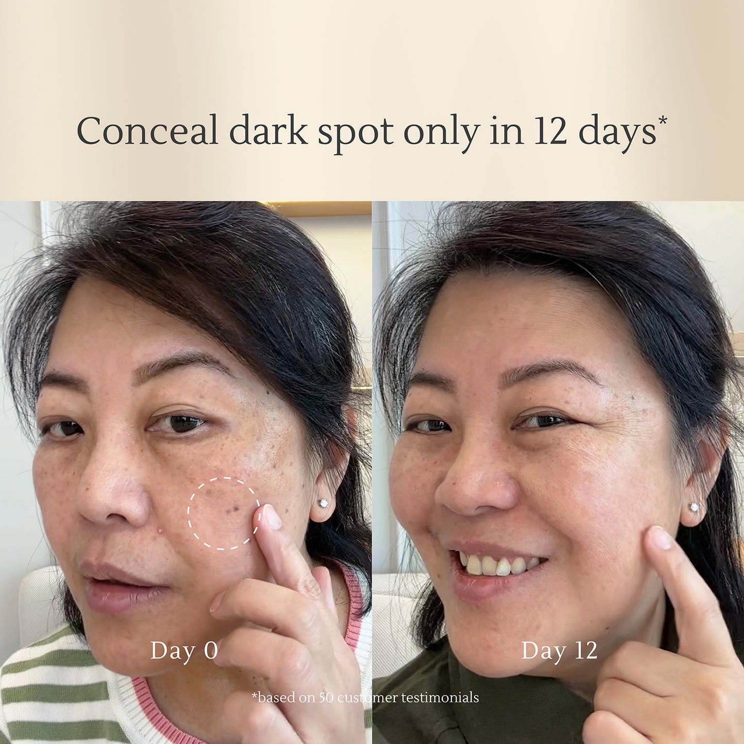 Intensive Dark Spot Care – Fades Acne Scars, Brightens Skin, Corrects Hyperpigmentation – Safe for All Skin Types