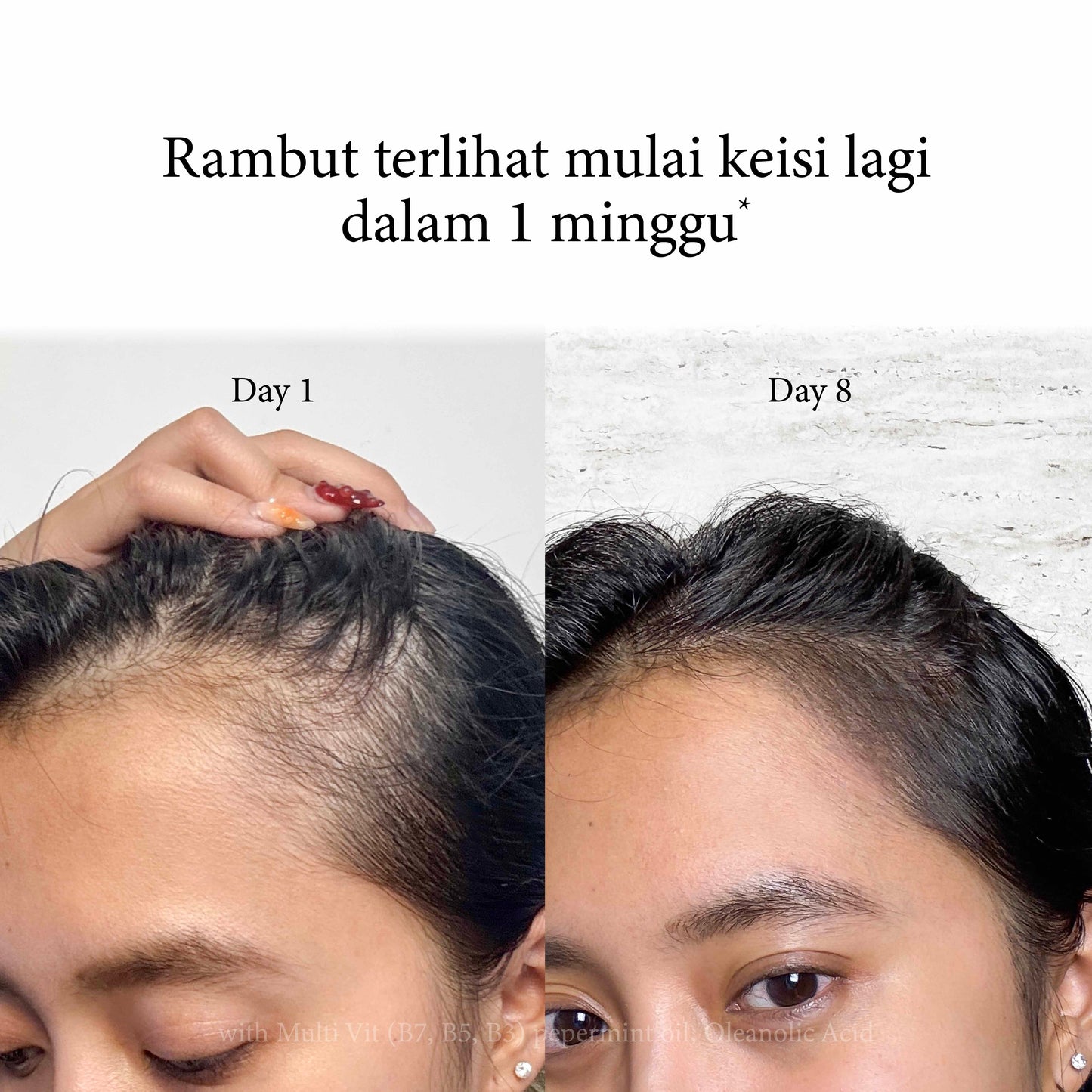 Hair Loss & Growth Essence - 50ml | Hair Essence | For Thinning & Hair Loss | Sensitive Scalp | Hair Care