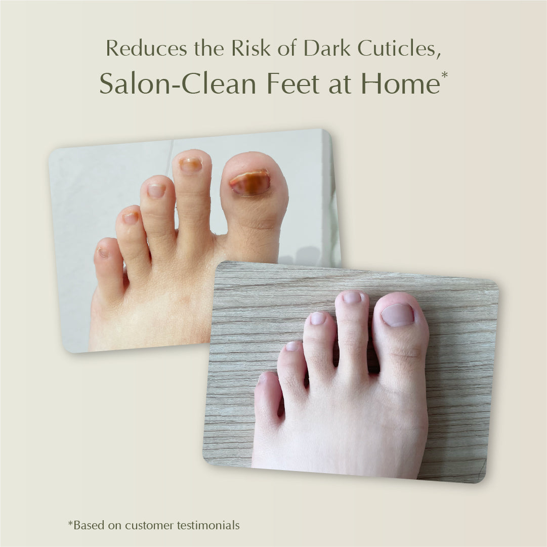 Cooling Foot Spray – Prevent Foot Odor, Reduce Calluses, and Relieve Cracked Heels – 50ml