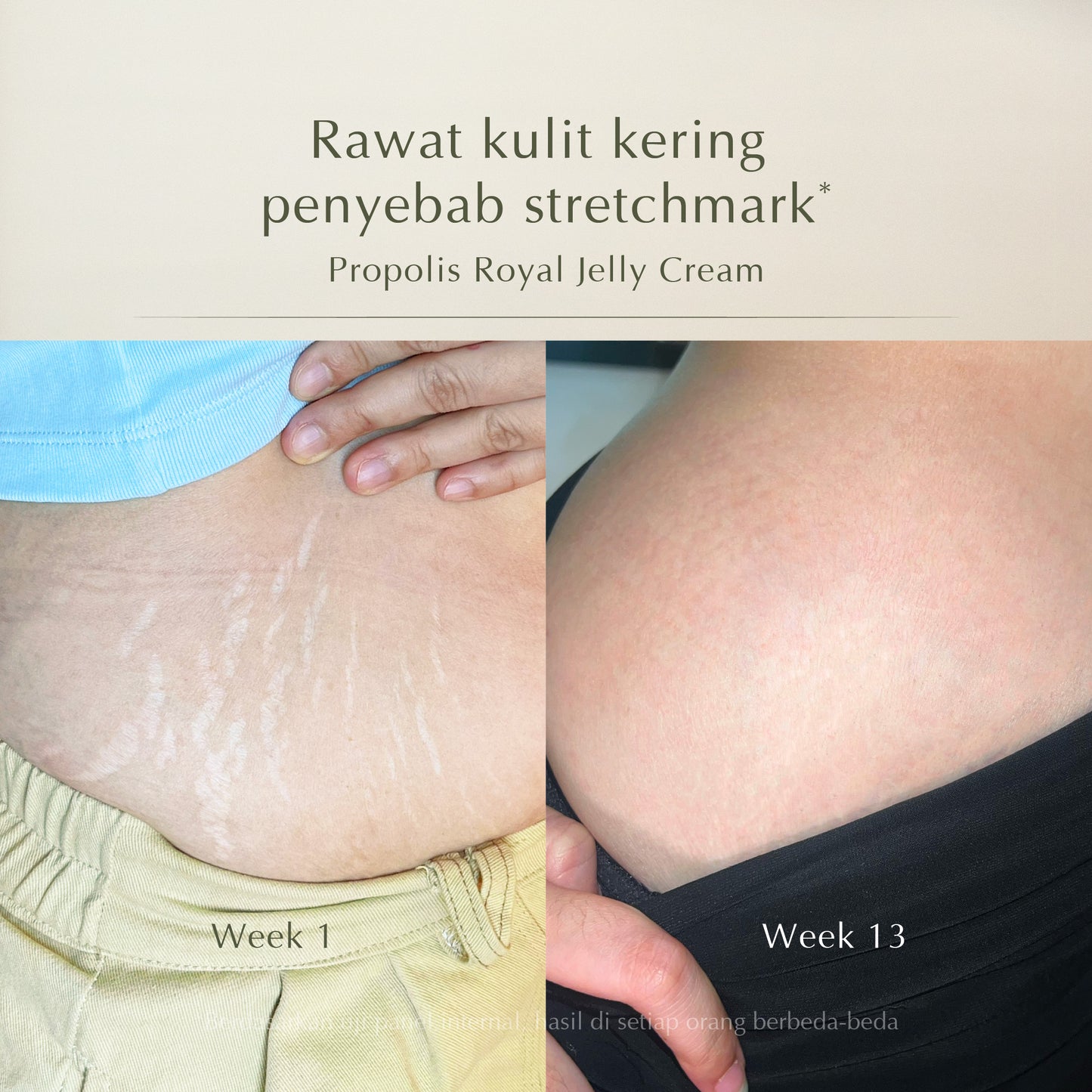 Royal Jelly Body Cream - Intense Hydration Body Butter 170gr