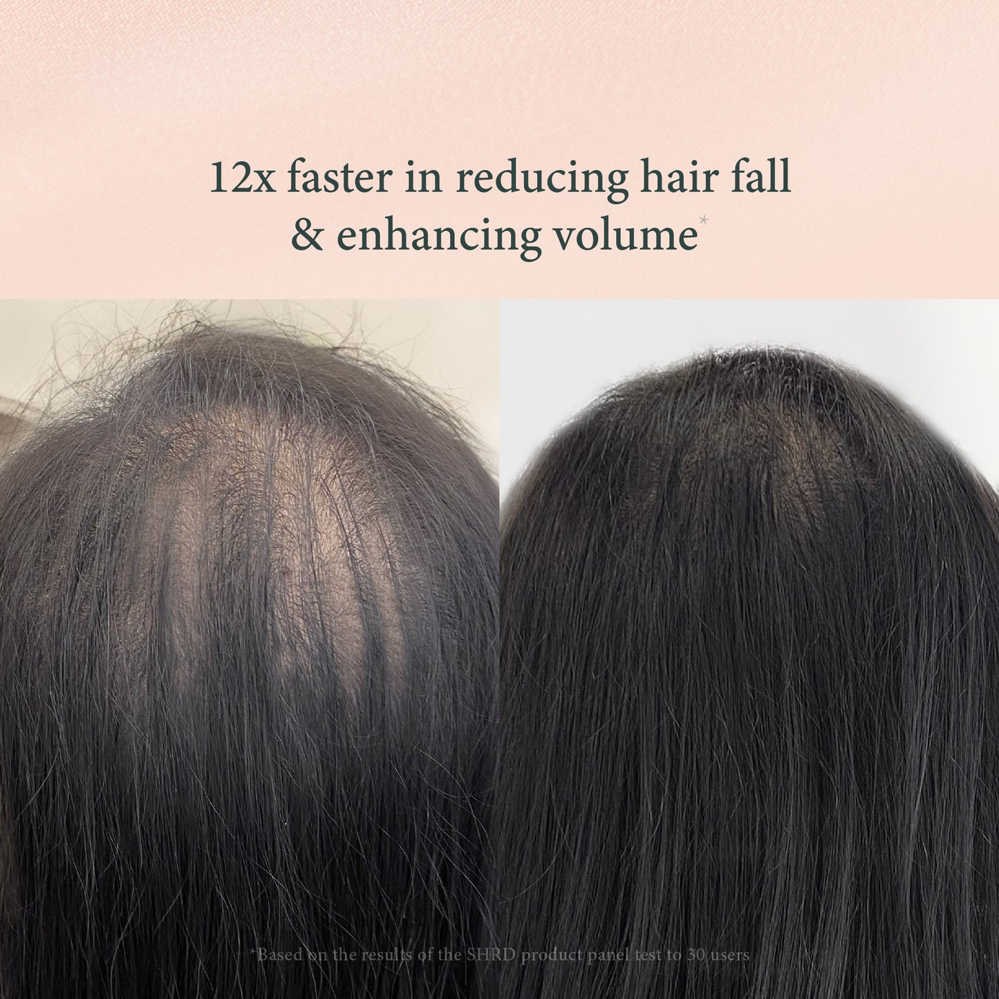 Red Ginseng Shampoo – Hair Loss Prevention & Scalp Revitalizer – 200ml