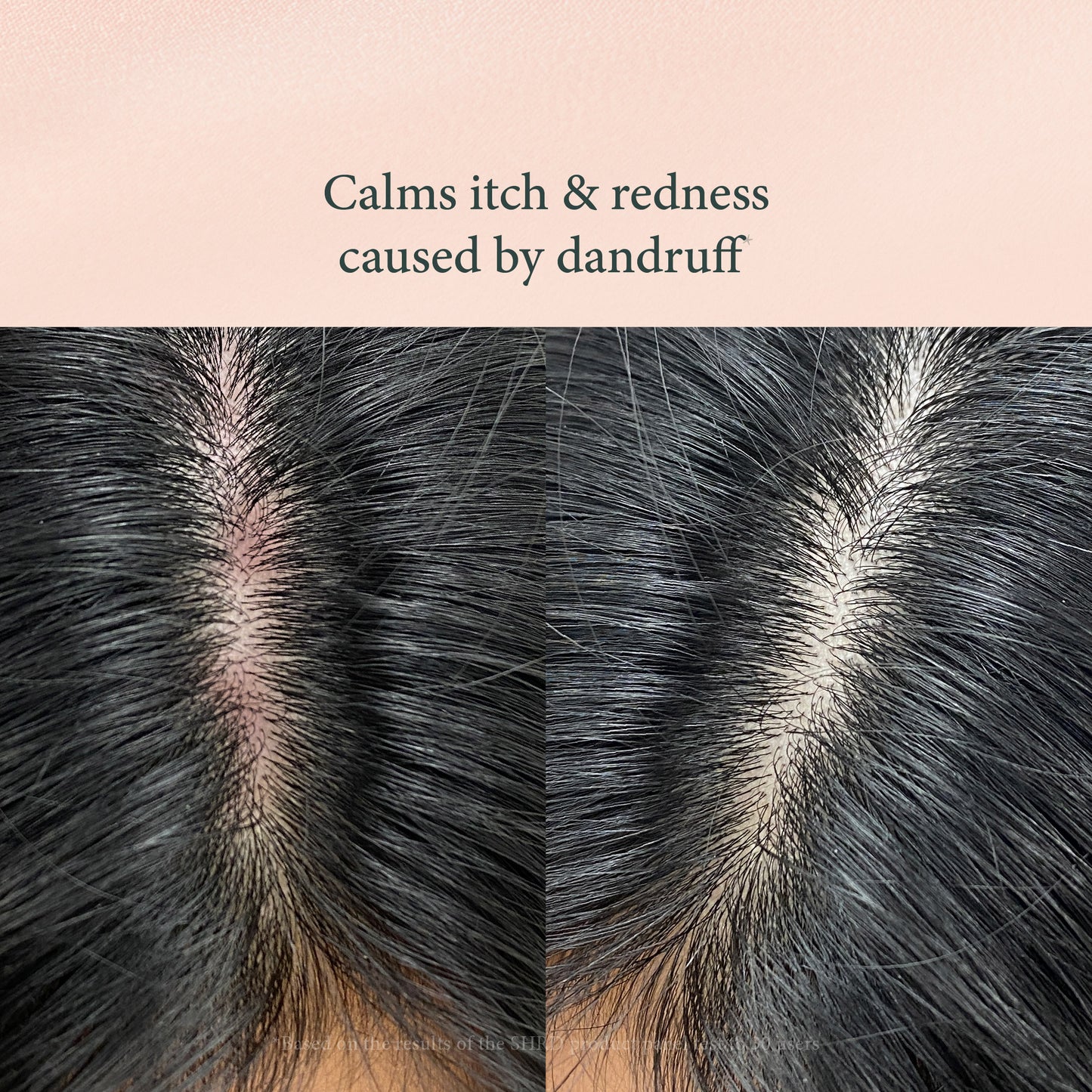 Keratin Shampoo - Oil Control, Lightweight Volume, Hair Treatment for Flat & Oily Hair - 250ml