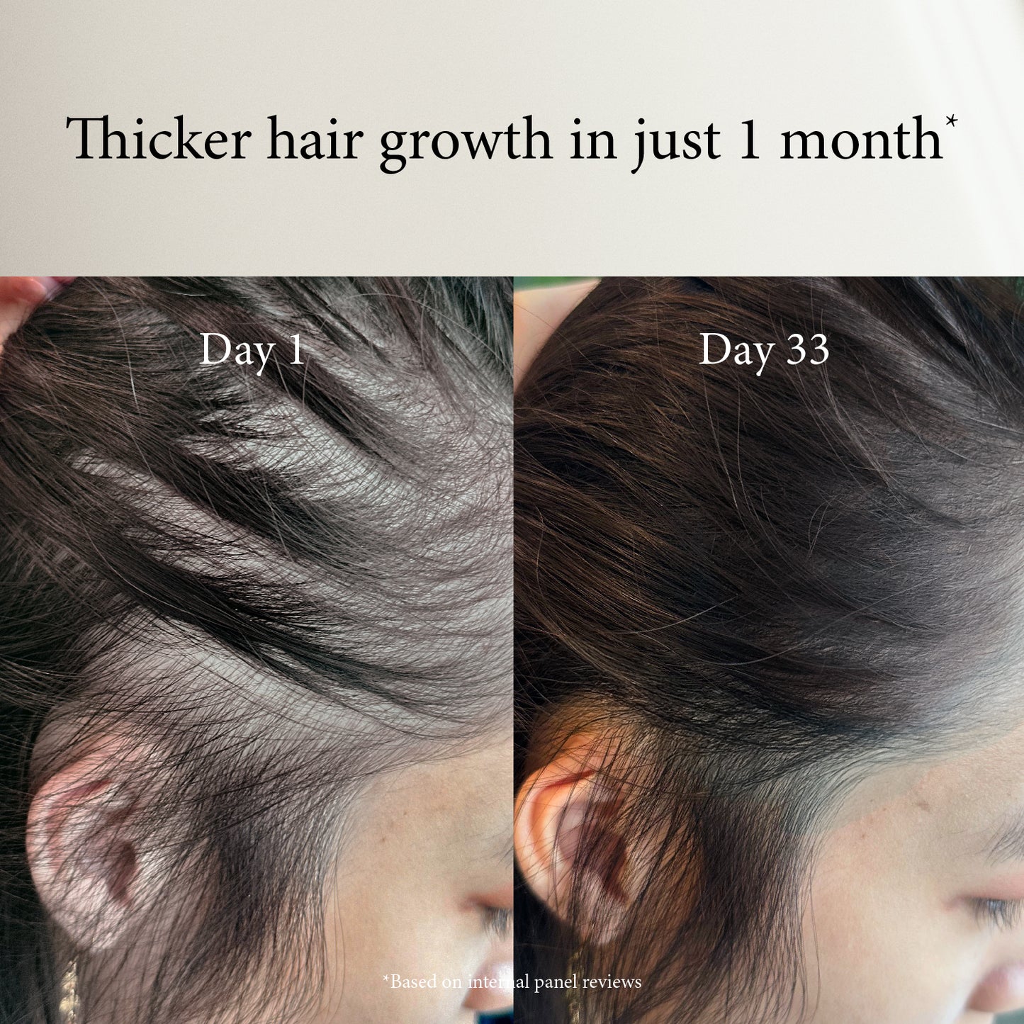 Flower Alley Hairfall Before After