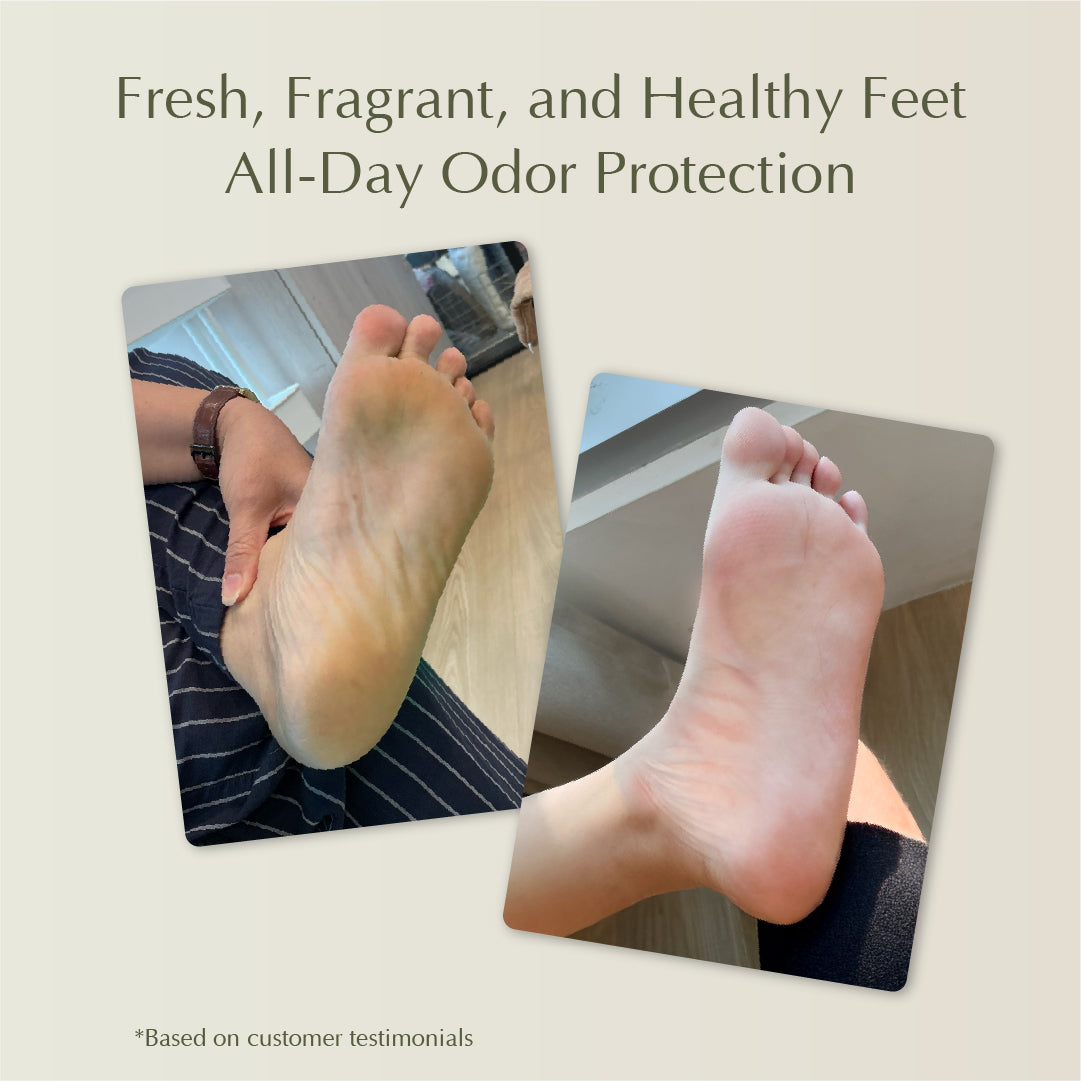 Cooling Foot Spray – Prevent Foot Odor, Reduce Calluses, and Relieve Cracked Heels – 50ml