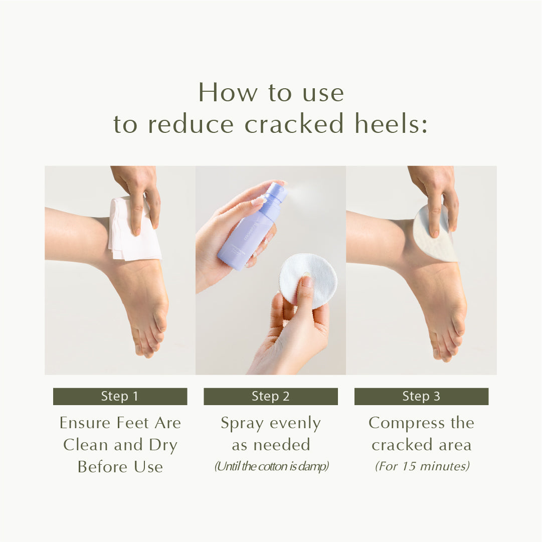 Cooling Foot Spray – Prevent Foot Odor, Reduce Calluses, and Relieve Cracked Heels – 50ml