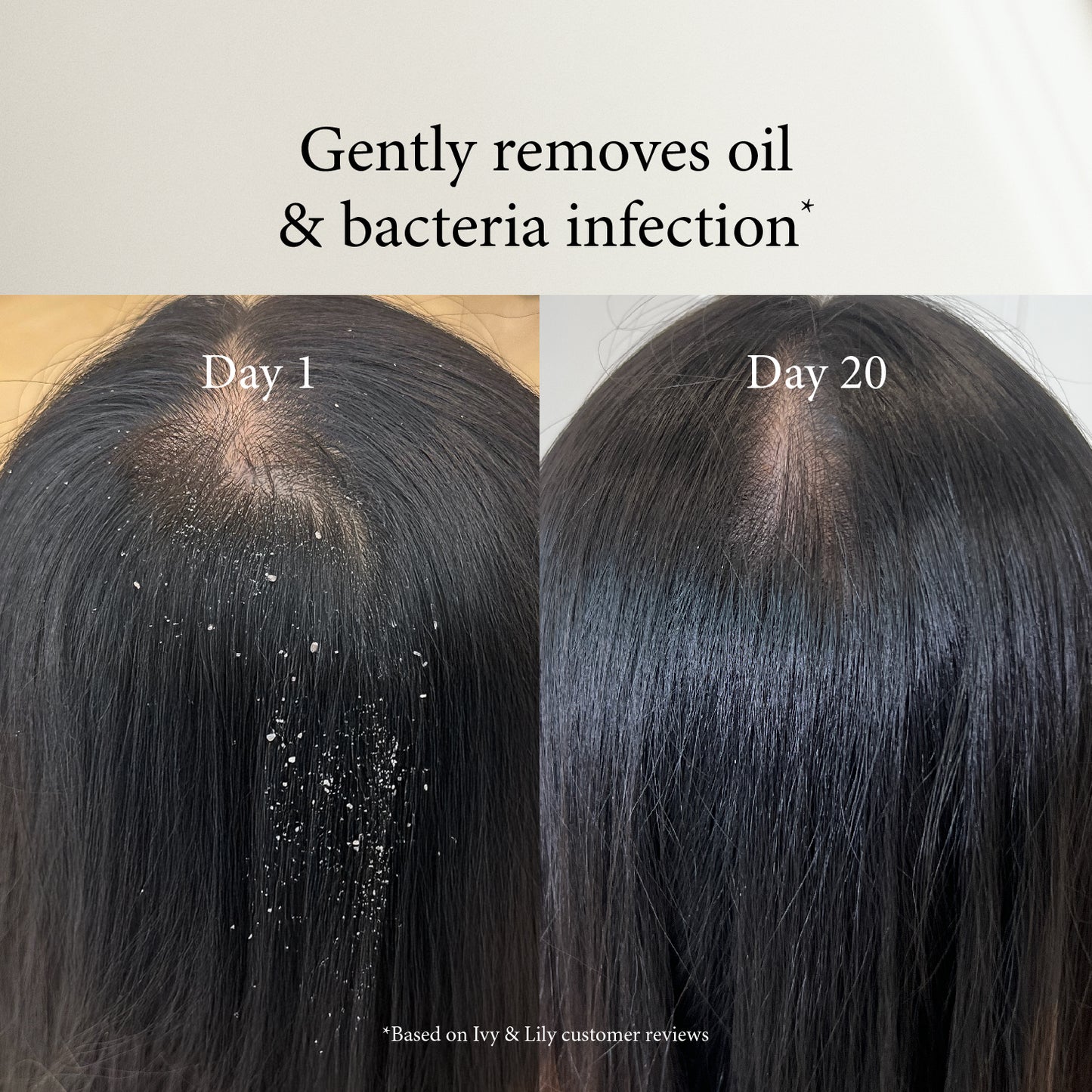 Ocean Breeze Shampoo with Piroctone Olamine - Before After 2