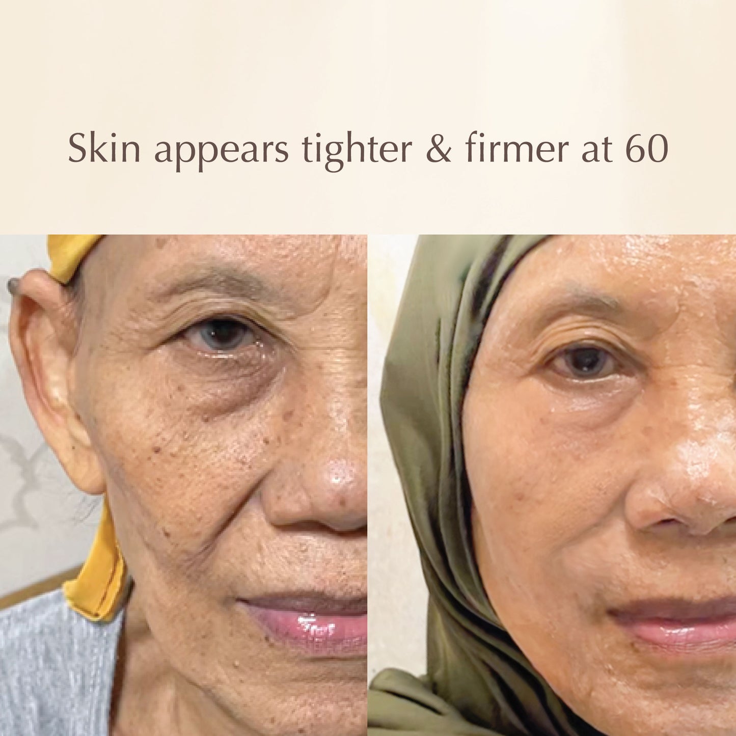 Pomegranate Mask – Brightening & Anti-Aging Face Mask with Pomegranate Extract, Niacinamide & Vitamin C – Fades Signs of Aging & Dullness – 100ml