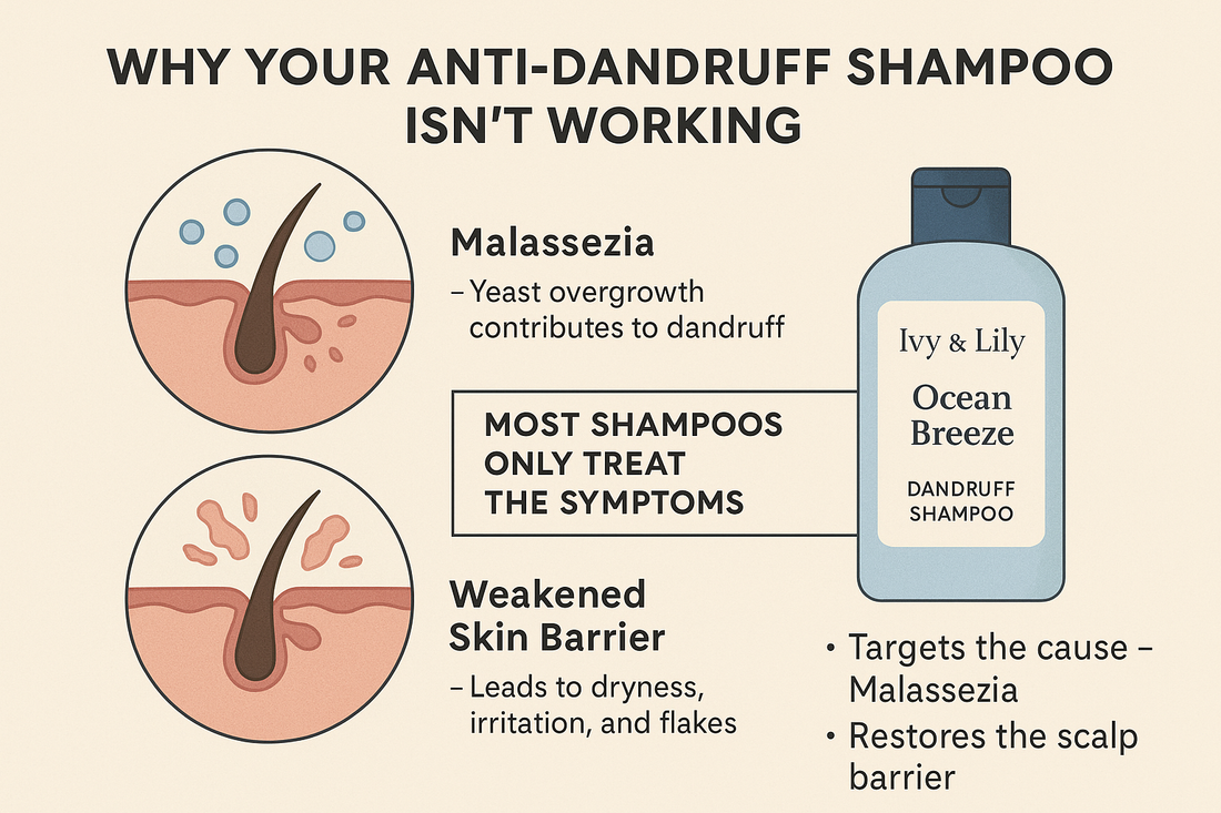 The Silent Reason Your Anti-Dandruff Shampoo Isn’t Working