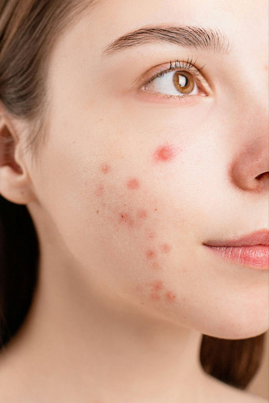 Skincare Ingredients 101: What Works Best for Your Skin Type (And What to Avoid Mixing!)