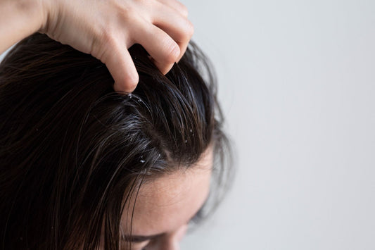 dandruff in 2025 back in spotlight