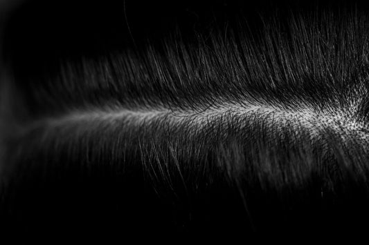 Why Do You Get Dandruff (And What You Can Actually Do About It)