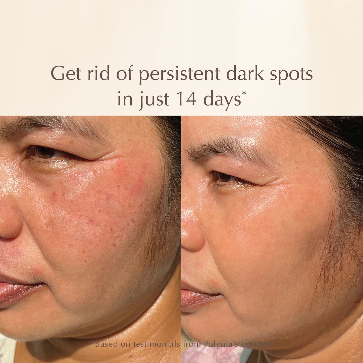 All-in-One Lifting Solution – Firms Skin, Reduces Wrinkles, Deeply Hydrates – Safe for All Skin Types Including Sensitive