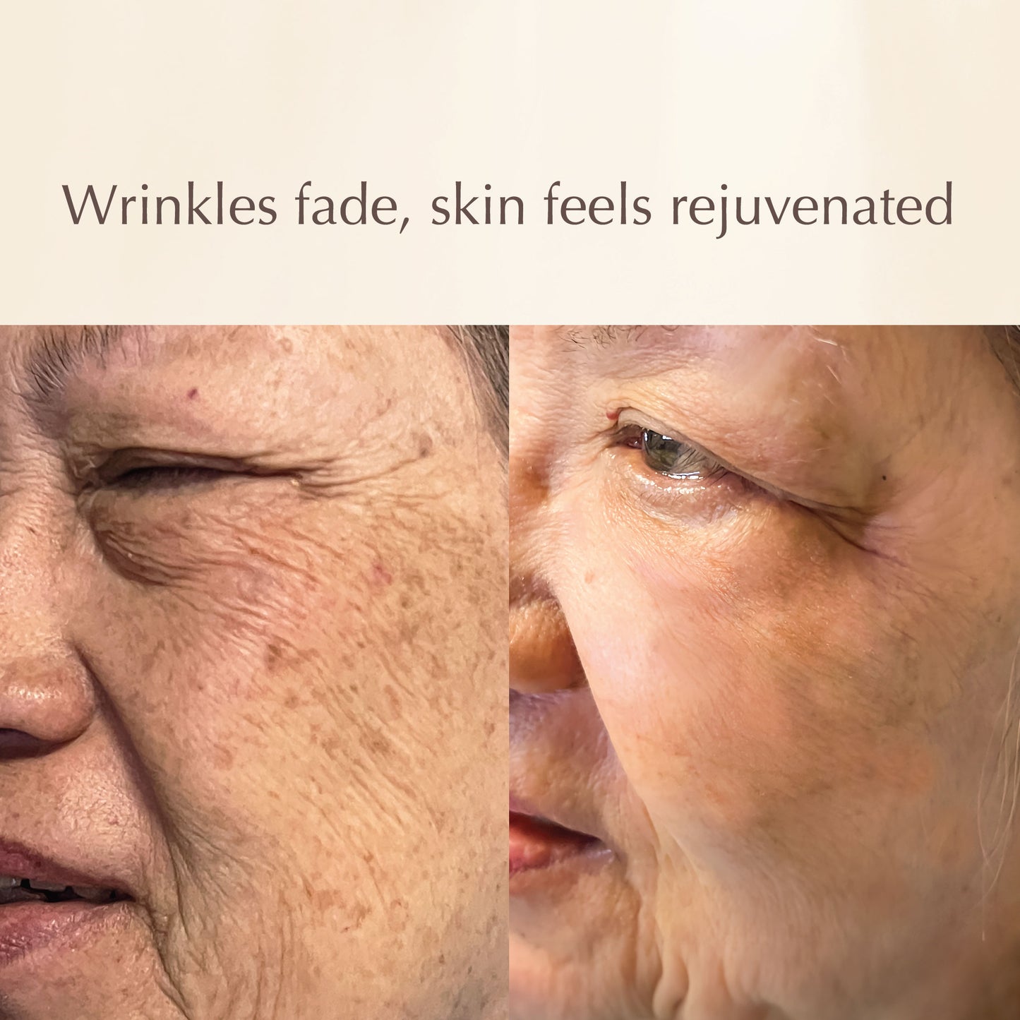 All-in-One Lifting Solution – Firms Skin, Reduces Wrinkles, Deeply Hydrates – Safe for All Skin Types Including Sensitive