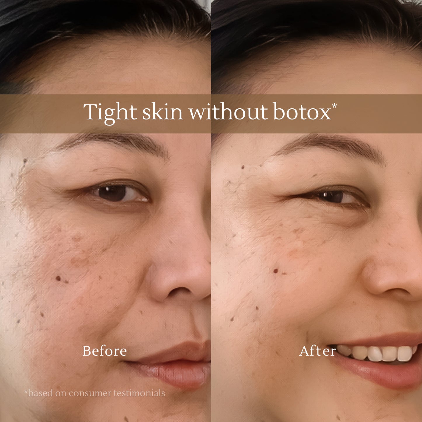 All-in-One Lifting Solution – Firms Skin, Reduces Wrinkles, Deeply Hydrates – Safe for All Skin Types Including Sensitive