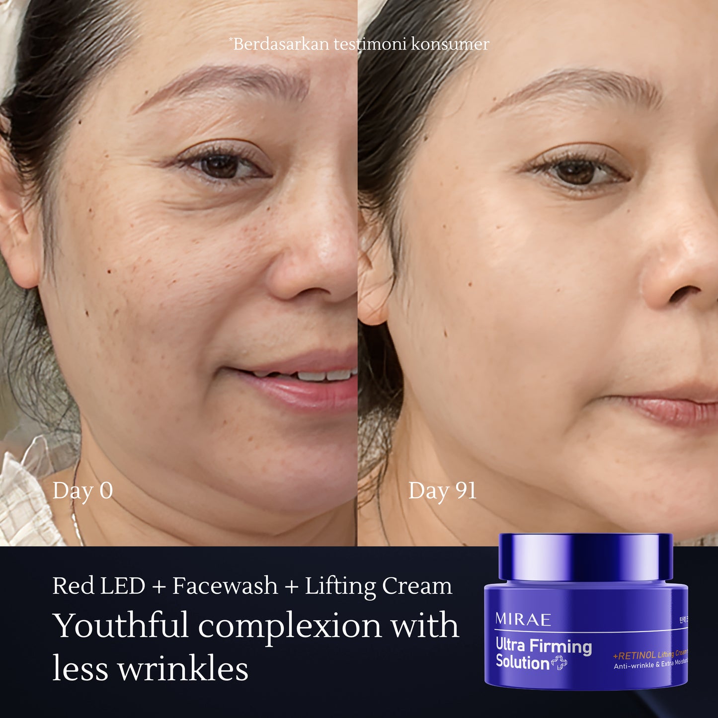 Lifting Cream – Skin Rejuvenation, Retinol for Anti-Aging & Brightening with Fast Absorption – 50ml