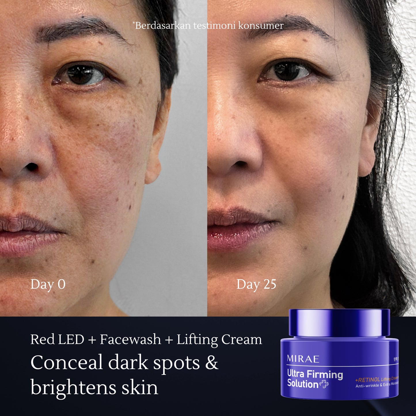 Lifting Cream – Skin Rejuvenation, Retinol for Anti-Aging & Brightening with Fast Absorption – 50ml