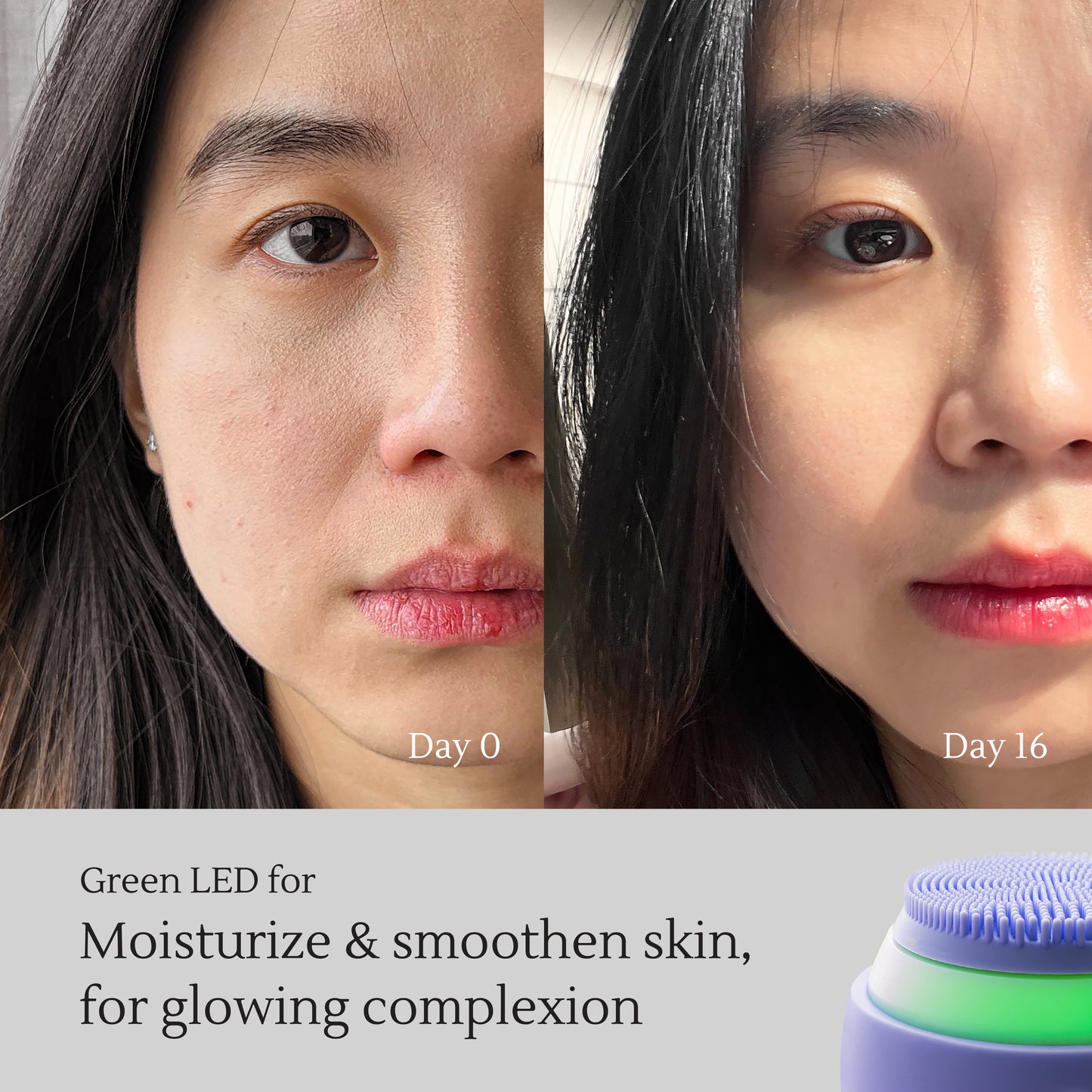 Facial Deep-Cleanser – Deep Cleansing, Pore Purification & Skin Lifting – Removes Oil & Dirt, Defines V-Shape Contour – All Skin Types