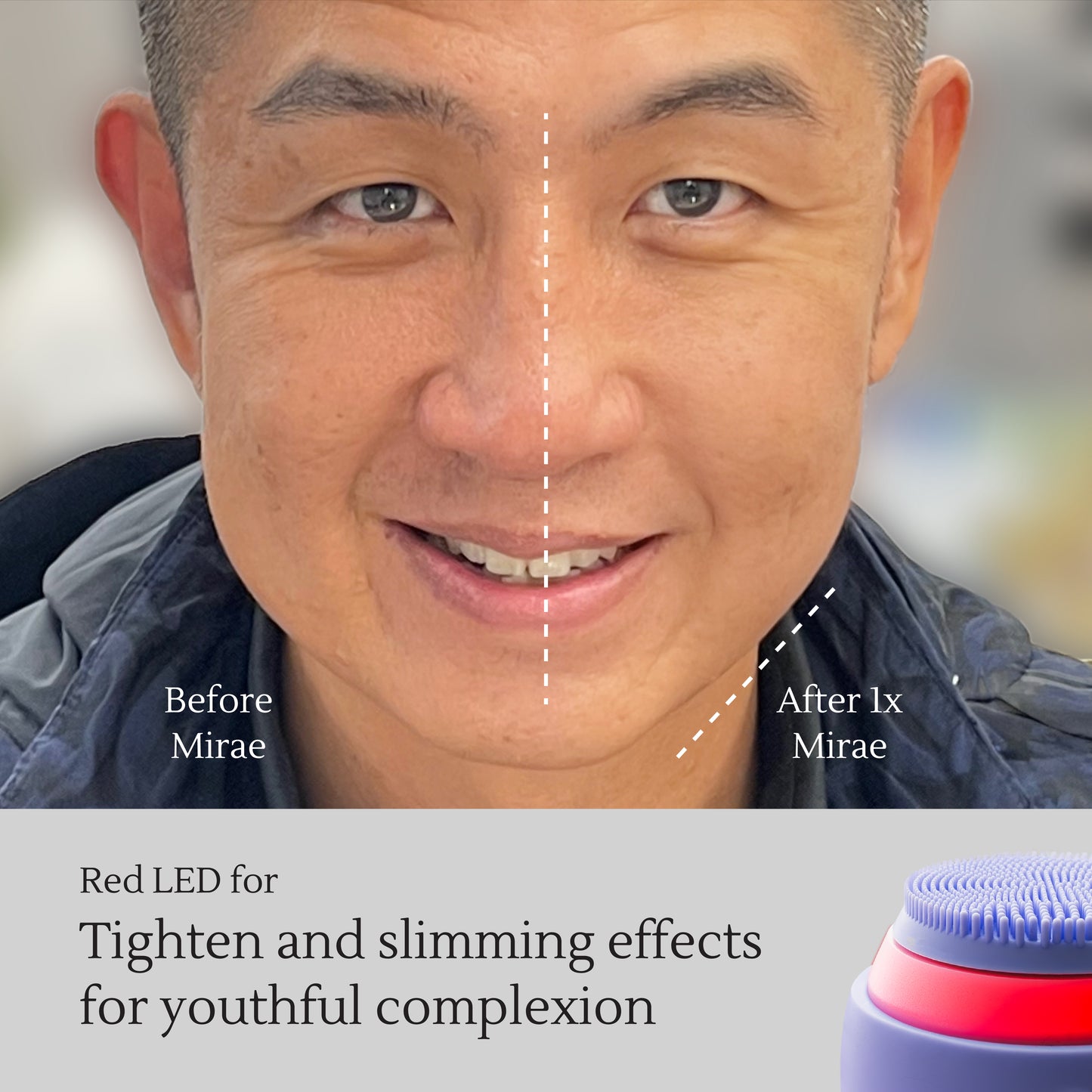 Facial Deep-Cleanser – Deep Cleansing, Pore Purification & Skin Lifting – Removes Oil & Dirt, Defines V-Shape Contour – All Skin Types