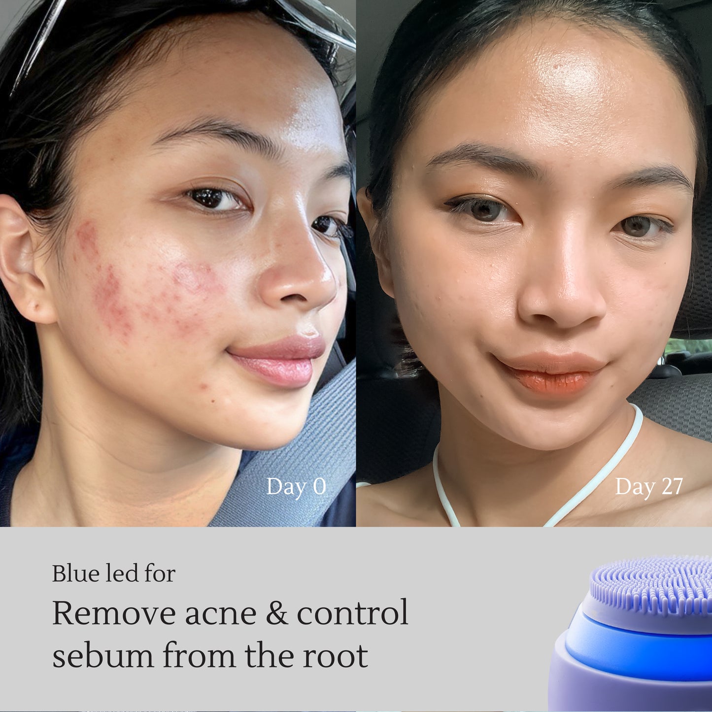 Facial Deep-Cleanser – Deep Cleansing, Pore Purification & Skin Lifting – Removes Oil & Dirt, Defines V-Shape Contour – All Skin Types