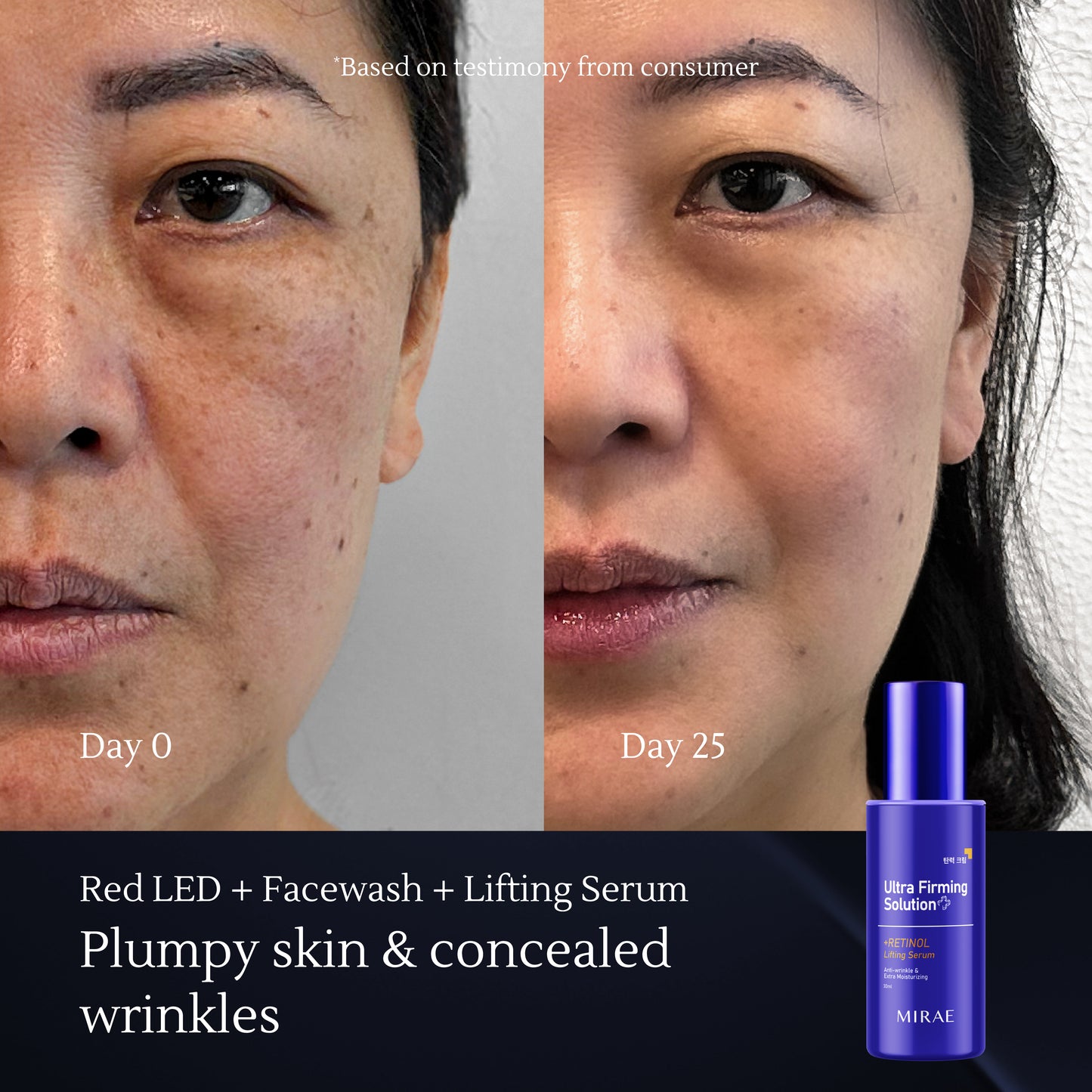 Retinol Lifting Serum – Anti-Aging & Skin Firming Serum with Retinol – Reduces Wrinkles & Fine Lines – Hydrates & Brightens – 30ml