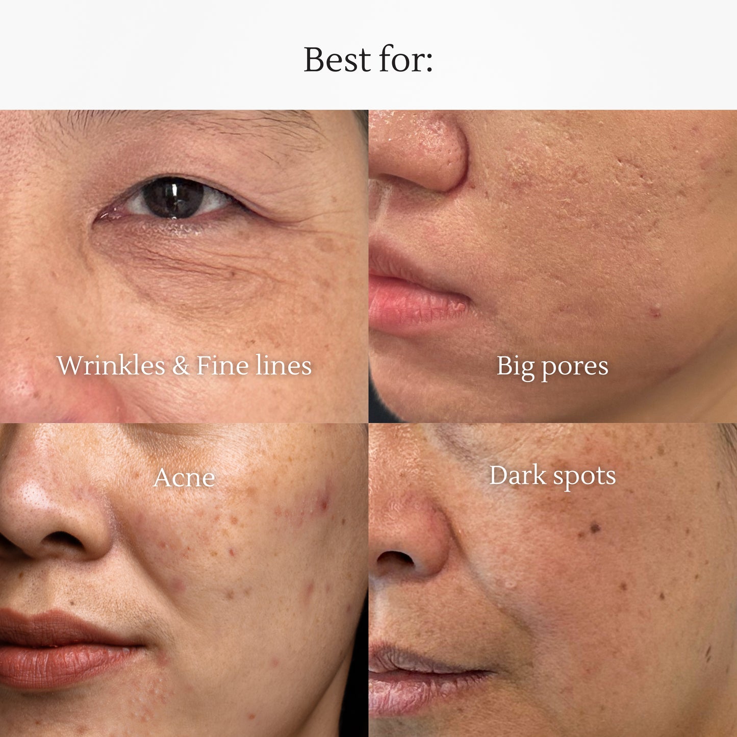 Retinol Lifting Serum – Anti-Aging & Skin Firming Serum with Retinol – Reduces Wrinkles & Fine Lines – Hydrates & Brightens – 30ml