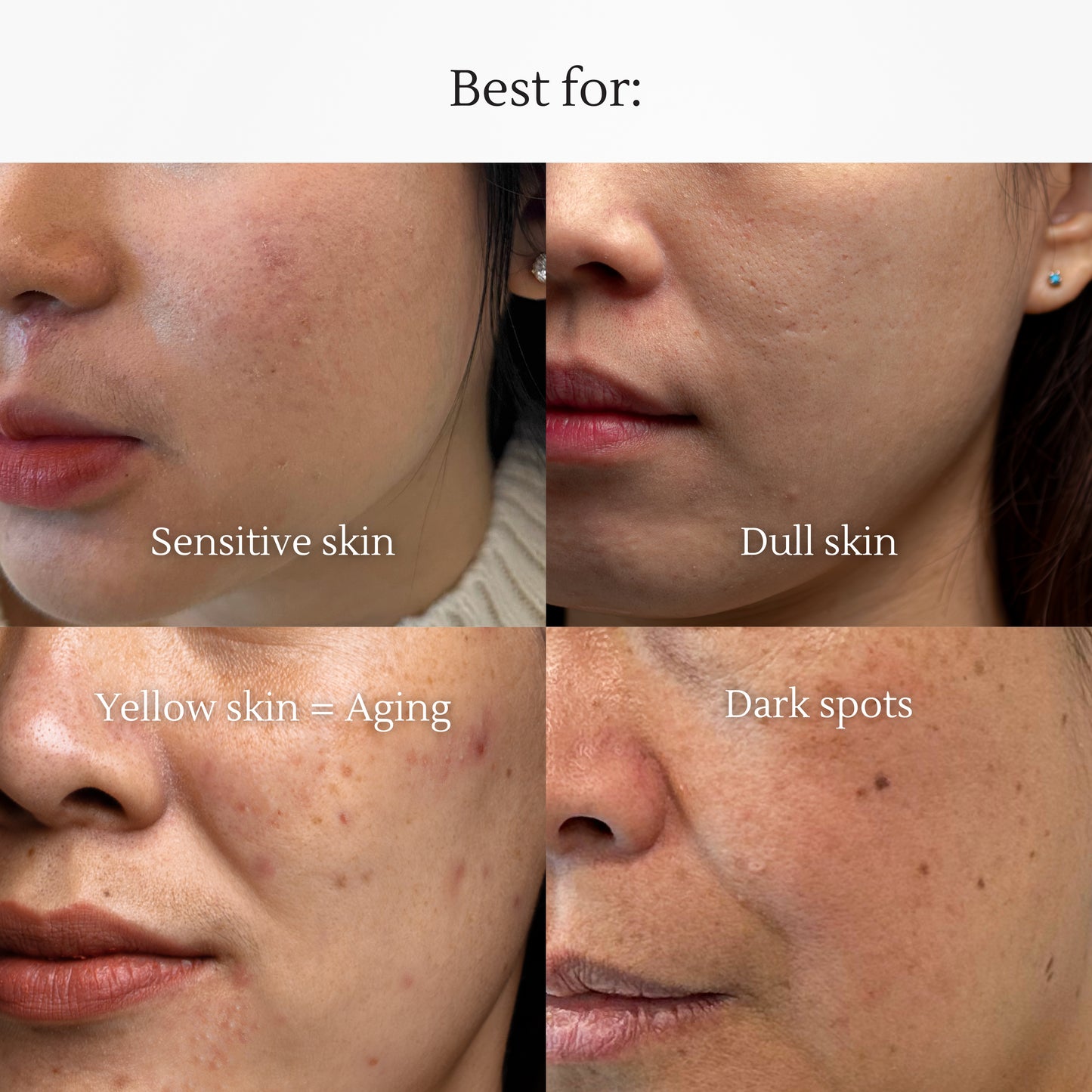 CICA Essence – Brightening Essence with Vitamin C & CICA – Reduces Acne Scars & Dark Spots – Antioxidant Protection & Hydration – 30ml