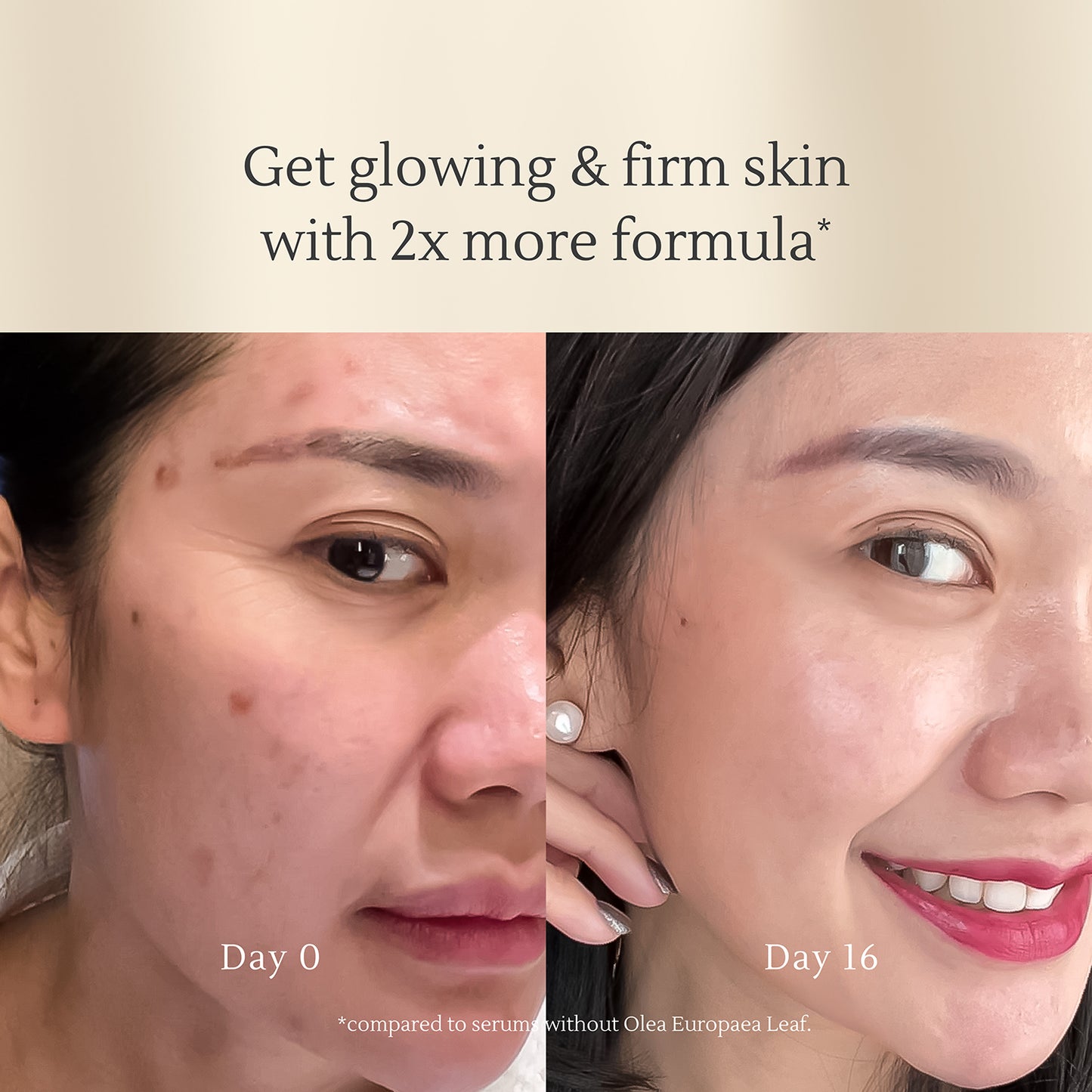 Micrite 3D Skin Serum – All-in-One Skin Repair Serum for Dull Skin, Acne, Fine Lines, & Uneven Skin Tone – 30ml