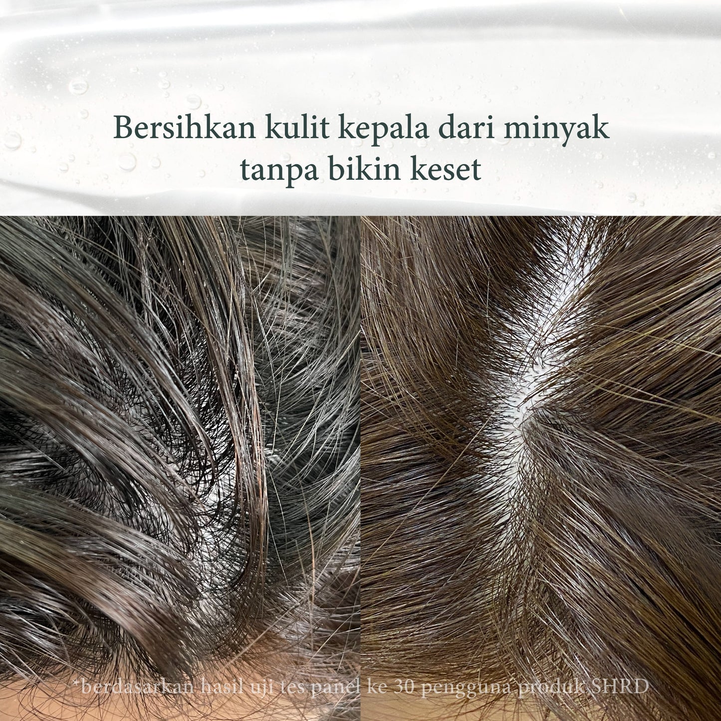 SH-RD Bundle - Red Ginseng & Hair Essence