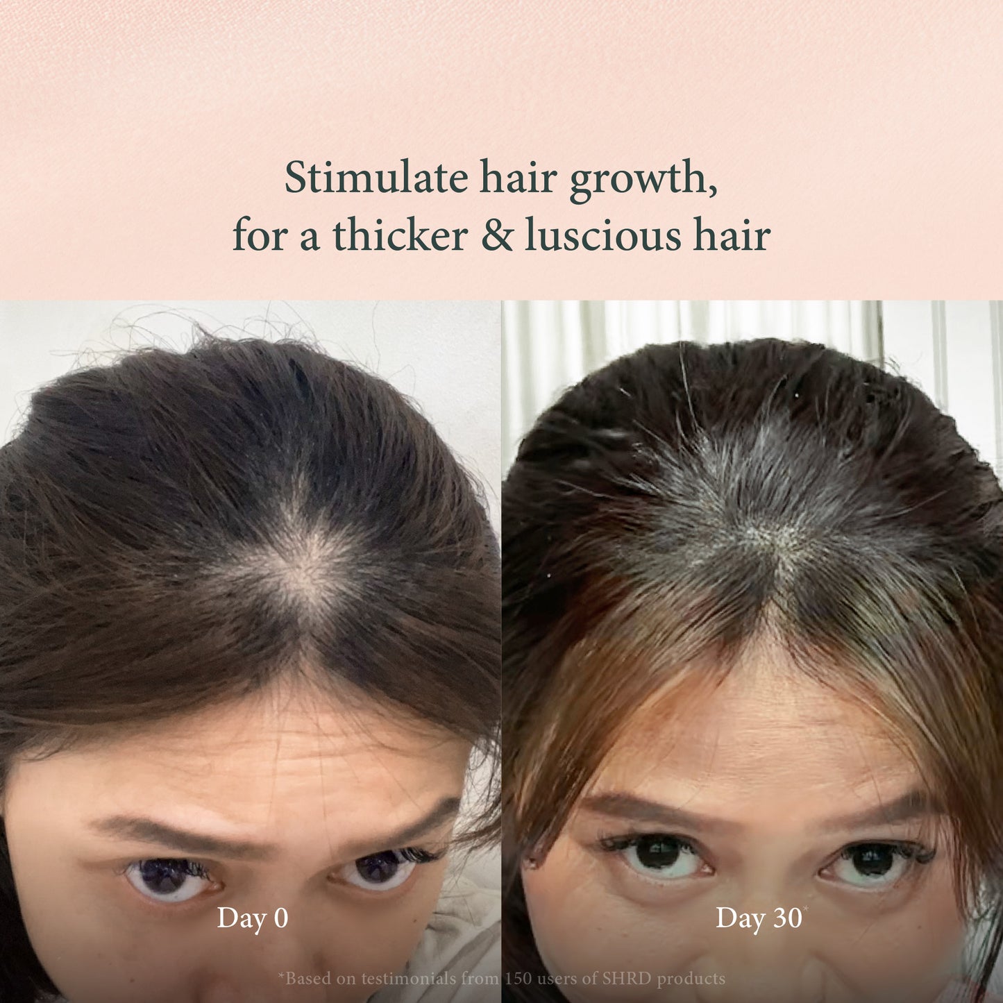 Scalp Massage Comb – Hair Growth Stimulator & Dandruff Remover