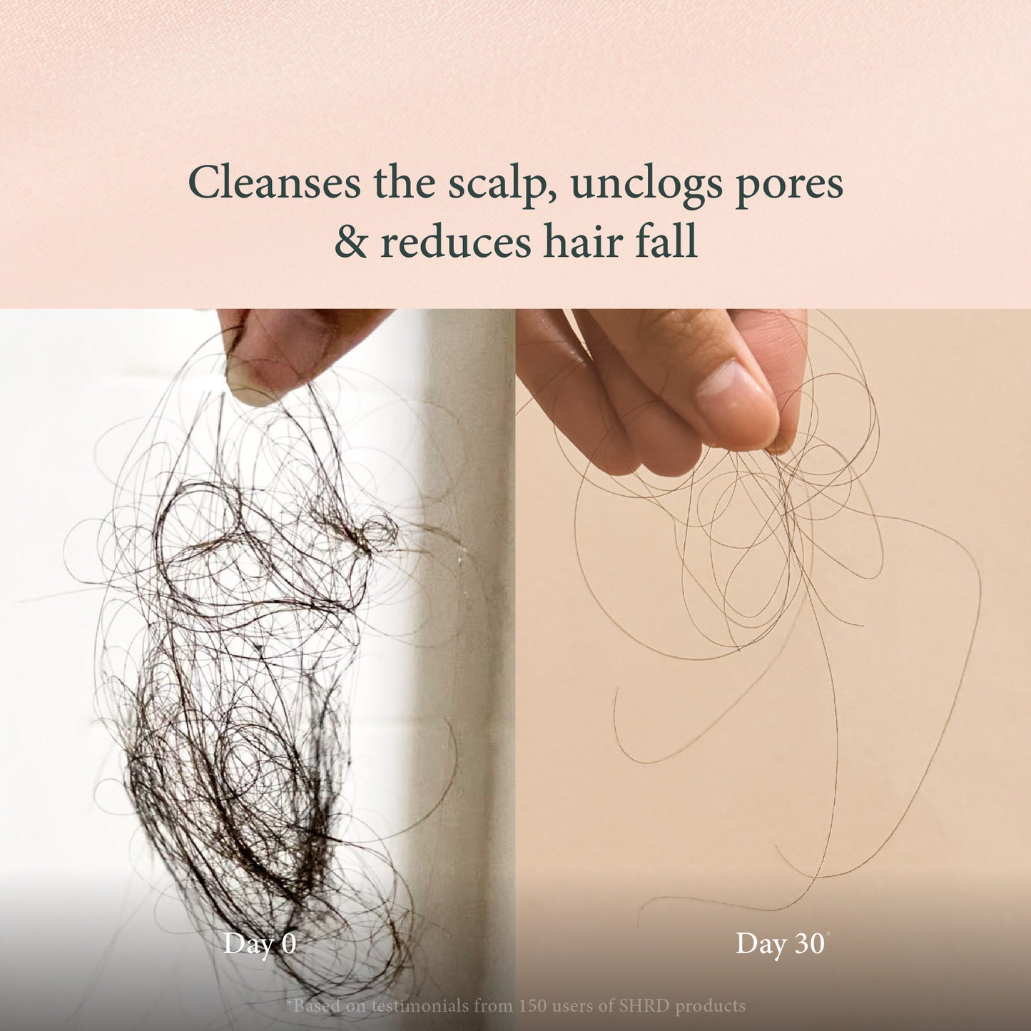 Scalp Massage Comb – Hair Growth Stimulator & Dandruff Remover