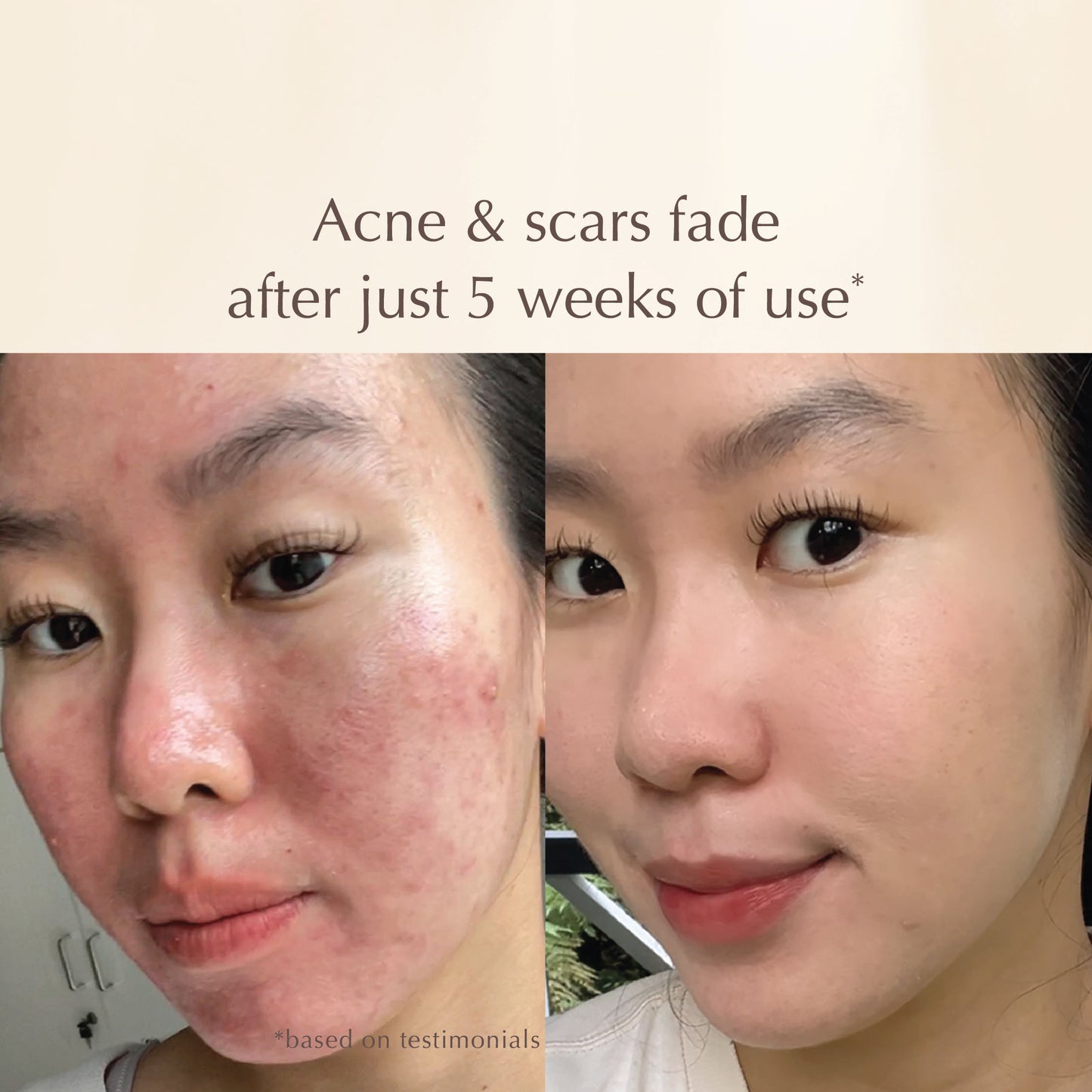 Orange Brightening Mask – Vitamin C, Vitamin E & Niacinamide – Fades Acne Scars (PIE & PIH) & Brightens Skin – 100ml