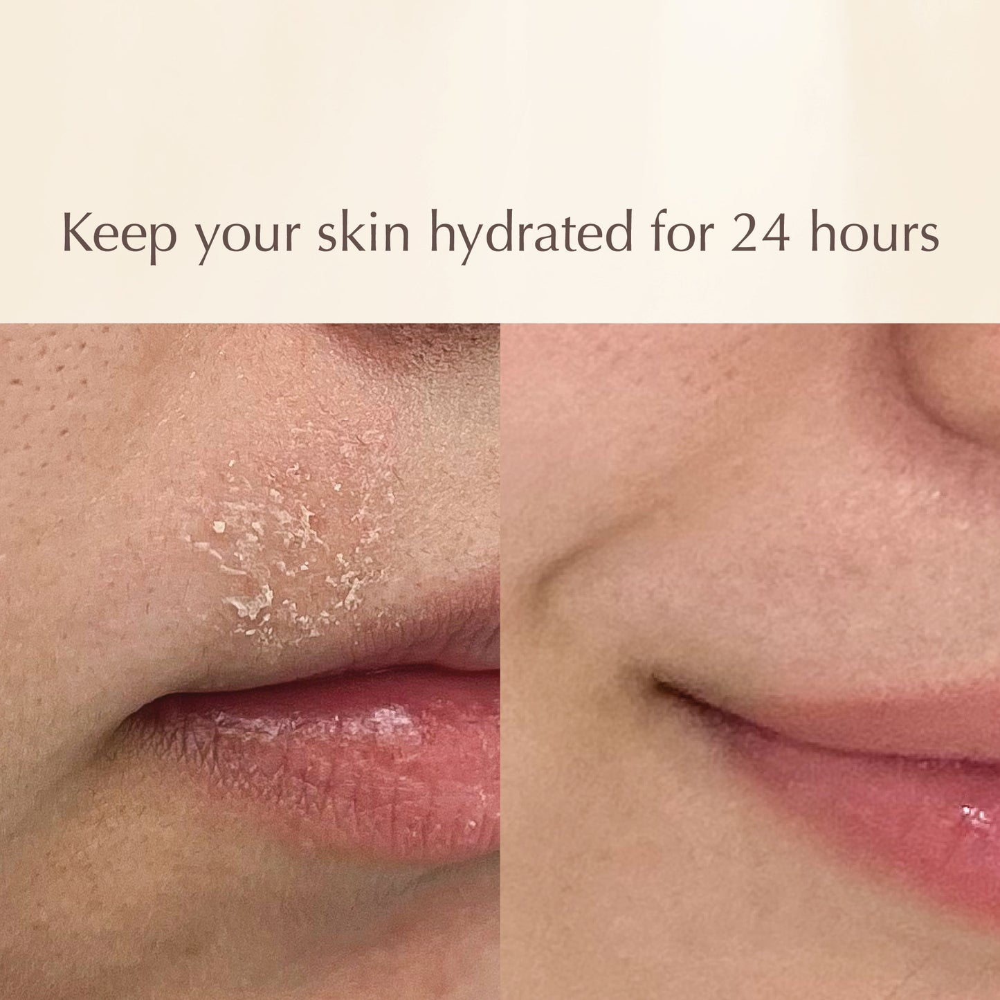 Prickly Hydrating Mask – Strengthening Ceramide Face Mask with Marine Collagen – Reduces Fine Lines & Pollution Damage – 100ml