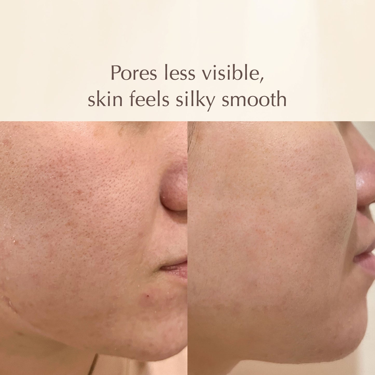 Prickly Hydrating Mask – Strengthening Ceramide Face Mask with Marine Collagen – Reduces Fine Lines & Pollution Damage – 100ml